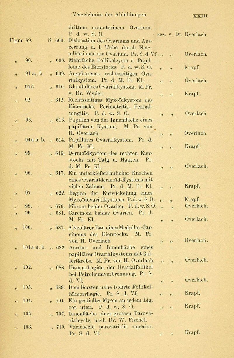 Figur 89. S. 600. „ 90. „ 608. „ 91 a., b. „ 609. „ 91c. „ 610. „ 92. „ 612. „ 93. ,, 613. „ . 94au.b. „ 614. „ 95. „ 616. » 96. „ 97. „ 617. „ 622. „ 98. „ 376. ,i 99. „ 681. „ 100. „ 681. „ lOlau.b. „ 682. ■'. 102. „ 688. „ 103. „ 689. „ 104. ,, 701. „ 105. „ 707. „ 106. „ 710. drittem anteuterinem Ovarium. P. d. w. S. 0. gez. v. Dr. Overlach. Dislocation des Ovariums und Aus- zerrung d. 1. Tube durch Netz- adhäsionen am Ovarium. Pr. S. d.Vf. „ „ Overlach. Mehrfache Follikelcyste u. Papil- lome des Eierstocks. P. d. w. S. O. „ „ Krapf. Angeborenes rechtsseitiges Ova- rialkystom. Pr. d. M. Fr. Kl. „ „ Overlach. Glanduläres Ovarialkystom. M. Pr. v. Dr. Wyder. „ „ Krapf. Rechtsseitiges Mysoidkystom des Eierstocks, Perimetritis, Perisal- pingitis. P. d. w. S. O. ,, ,, Overlach. Papillen von der Innenfläche eines papillären Kystom. M. Pr. von H. Overlach „ „ Overlach. Papilläres Ovarialkystom. Pr. d. M. Fr. Kl. „ „ Krapf. Dermoidkystom des rechten Eier- stocks mit Talg u. Haaren. Pr. d. M. Fr. Kl. „ „ Overlach. Ein unterkieferähnlicher Knochen eines Ovarialdermoi'd-Kystoms mit vielen Zähnen. Pr. d. M. Fr. Kl. „ „ Krapf. Beginn der Entwickelung eines Myxoidovarialkystoms P.d.w.S.O. ,, „ Krapf. Fibrom beider Ovarien. P. d.w.S.O. „ „ Overlach. Carcinom beider Ovarien. Pr. d. M. Fr. Kl. „ „ Overlach. Alveolärer Bau einesMedullar-Car- cinoms des Eierstocks. M. Pr. von H. Overlach „ ,, Overlach. Aussen- und Innenfläche eines papillären Ovarialkystoms mit Gal- lertkrebs. M. Pr. von H. Overlach „ „ Overlach. Hämorrhagien der Ovarialfollikel bei Petroleumverbrennung. Pr. S. d. Vf. „ ?) Overlach. Dem Bersten nahe isolirte Follikel- hämorrhagie. Pr. S. d. Vf. „ „ Krapf. Ein gestieltes Myom an jedem Lig. rot. uteri. P. d. w. S. O. „ „ Krapf. Innenfläche einer grossen Parova- rialcyste, nach Dr. W. Fischel. Varicocele parovarialis superior. Pr. S. d. Vf. „ „ Krapf-