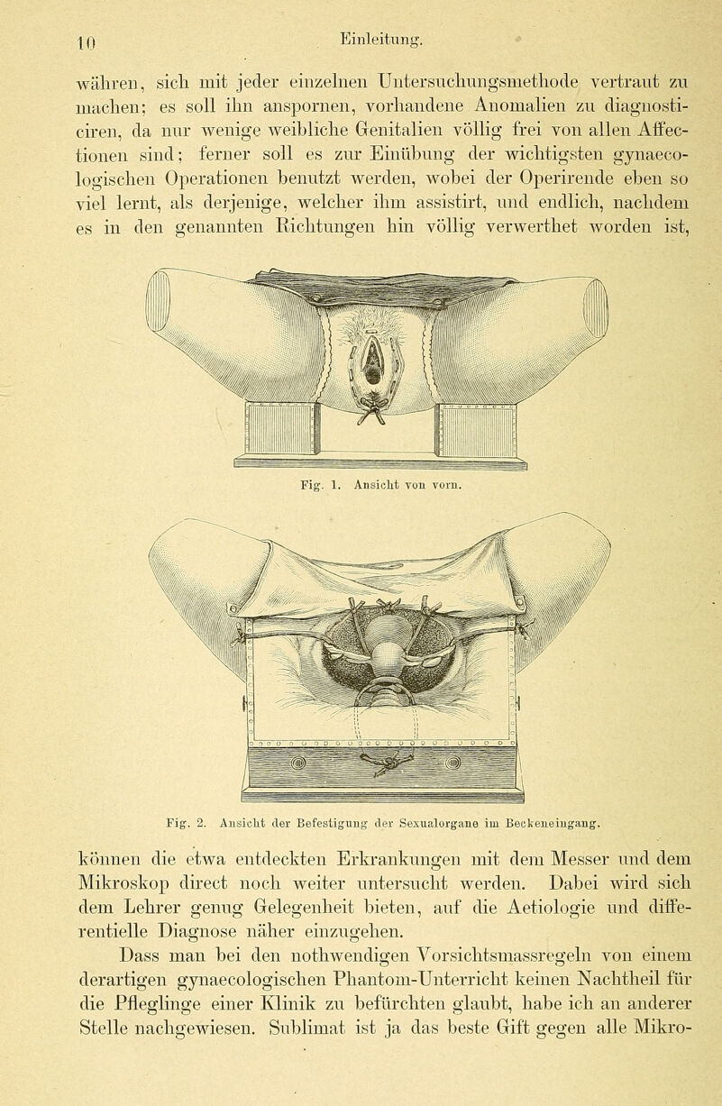 währen, sich mit jeder einzelnen Untersuchungsmethode vertraut zu machen; es soll ihn anspornen, vorhandene Anomalien zu diagnosti- ciren, da nur wenige weibliche Genitalien völlig frei von allen Affec- tionen sind; ferner soll es zur Einübung der wichtigsten gynaeco- logischen Operationen benutzt werden, wobei der Operirende eben so viel lernt, als derjenige, welcher ihm assistirt, und endlich, nachdem es in den genannten Richtungen hin völlig verwerthet worden ist, Fig. 1. Ansicht von vorn. Fig. 2. Ansieht der Befestigung der Sexualorgane im Beekeneingang. können die etwa entdeckten Erkrankungen mit dem Messer und dem Mikroskop direct noch weiter untersucht werden. Dabei wird sich dem Lehrer genug Gelegenheit bieten, auf die Aetiologie und diffe- rentielle Diagnose näher einzugehen. Dass man bei den nothwendigen Vorsichtsmassregeln von einem derartigen gynaecologischen Phantom-Unterricht keinen Nachtheil für die Pfleglinge einer Klinik zu befürchten glaubt, habe ich an anderer Stelle nachgewiesen. Sublimat ist ja das beste Gift gegen alle Mikro-