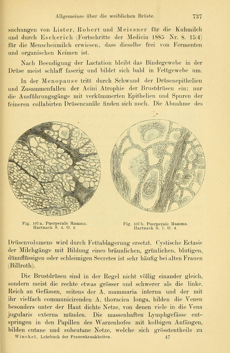 suchtingen von Lister, Robert und Meissner für die Kuhmilch und durch Escherich (Fortschritte der Medicin 1885 Nr. 8. 15/4) für die Menschenmilch erwiesen, dass dieselbe frei von Fermenten und organischen Keimen ist. Nach Beendigung der Lactation bleibt das Bindegewebe in der Drüse meist schlaff faserig und bildet sich bald in Fettgewebe um. In der Menopause tritt durch Schwund der Drüsenepithelien und Zusammenfallen der Acini Atrophie der Brustdrüsen ein; nur die Ausführungsgänge mit verkümmerten Epithelien und Spuren der feineren collabirten Drüsencanäle finden sich noch. Die Abnahme des Fig. 107a. Puerperale Mamma. Hartnack S. 4. 0. 2. Fig. 107 b. Puerperale Mamma. Hartnack S. 7. 0. 4. Drüsenvolumens wird durch Fettablagerung ersetzt. Cystische Ectasie der Milchgänge mit Bildung eines bräunlichen, grünlichen, blutigen, dünnflüssigen oder schleimigen Secretes ist sehr häufig bei alten Frauen (Billroth). Die Brustdrüsen sind in der Regel nicht völlig einander gleich, sondern meist die rechte etwas grösser und schwerer als die linke. Reich an Grefässen, seitens der A. mammaria interna und der mit ihr vielfach communicirenden A. thoracica longa, bilden die Venen besonders unter der Haut dichte Netze, von denen viele in die Vena jugularis externa münden. Die massenhaften Lymphgefässe ent- springen in den Papillen des Warzenhofes mit kolbigen Anfängen, bilden cutane und subcutane Netze, welche sich grösstentheils zu Win ekel, Lehrbuch der Frauenkrankheiten. 47