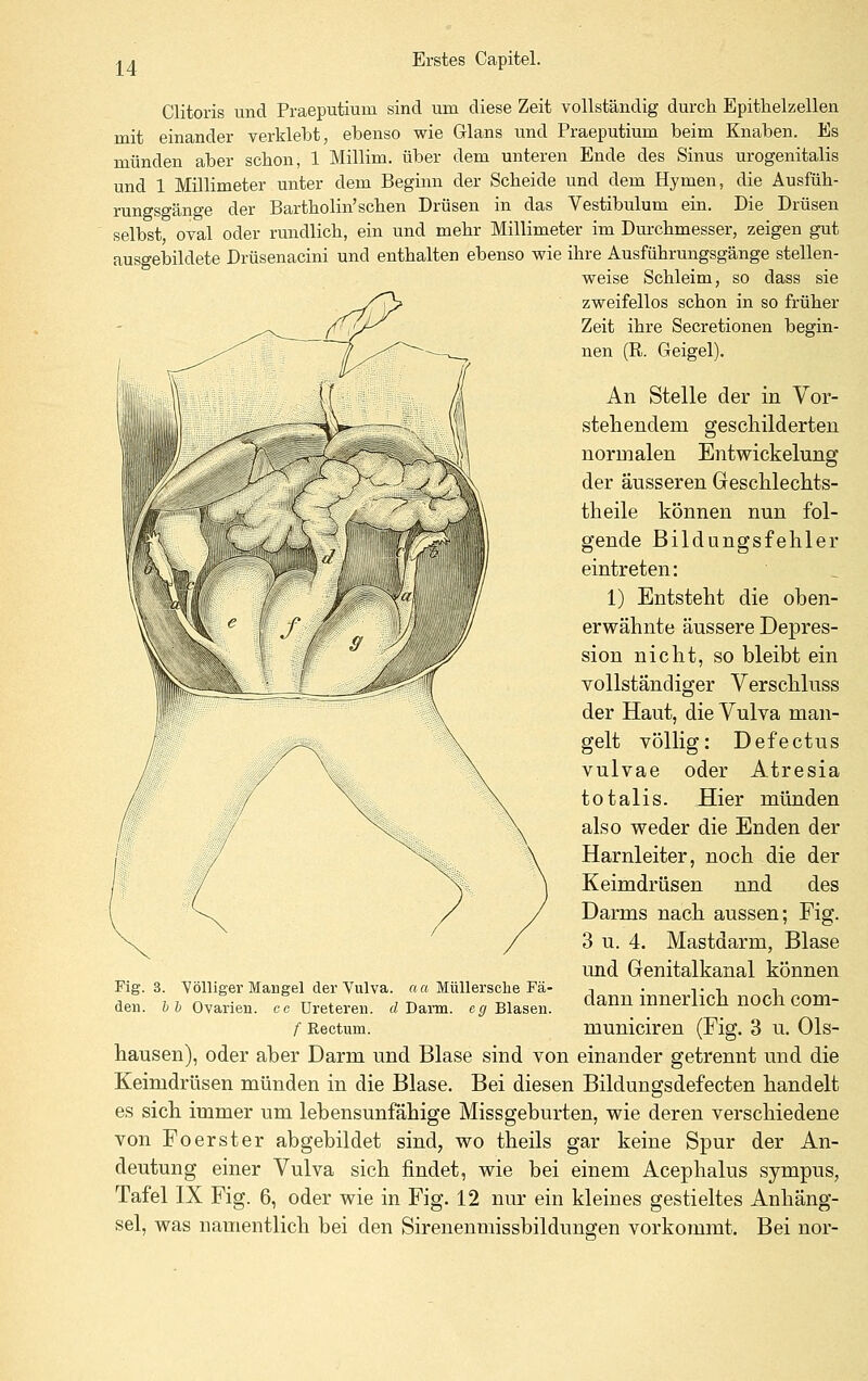 Clitoris und Praeputium sind um diese Zeit vollständig durch Epithelzellen mit einander verklebt, ebenso wie Glans und Praeputium beim Knaben. Es münden aber schon, 1 Millim. über dem unteren Ende des Sinus urogenitalis und 1 Millimeter unter dem Beginn der Scheide und dem Hymen, die Ausfüh- rungsgänge der Bartholin'schen Drüsen in das Vestibulum ein. Die Drüsen selbst oval oder rundlich, ein und mehr Millimeter im Durchmesser, zeigen gut ausgebildete Drüsenacini und enthalten ebenso wie ihre Ausführungsgänge stellen- weise Schleim, so dass sie zweifellos schon in so früher Zeit ihre Secretionen begin- nen (R. Geigel). An Stelle der in Vor- stehendem geschilderten normalen Entwickelung der äusseren Gesclilechts- theile können nun fol- gende Bildungsfehler eintreten: 1) Entsteht die oben- erwähnte äussere Depres- sion nicht, so bleibt ein vollständiger Verschluss der Haut, die Vulva man- gelt völlig: Defectus vulvae oder Atresia totalis. Hier münden also weder die Enden der Harnleiter, noch die der Keimdrüsen und des Darms nach aussen; Fig. 3 u. 4. Mastdarm, Blase und Genitalkanal können Fig. 3. Völliger Mangel der Vulva, a a MüUersche Fä- , . t ^ n den. Z.i Ovarien, .c üreteren. rf Darm, c^ Blasen. dann innerlich lioch COm- f Rectum. municiren (Fig. 3 u. 01s- hausen), oder aber Darm und Blase sind von einander getrennt und die Keimdrüsen münden in die Blase, Bei diesen Bildungsdefecten handelt es sich immer um lebensunfähige Missgeburten, wie deren verschiedene von Fo erst er abgebildet sind, wo theils gar keine Spur der An- deutung einer Vulva sich findet, wie bei einem Acephalus sympus, Tafel IX Fig. 6, oder wie in Fig. 12 nur ein kleines gestieltes Anhäng- sel, was namentlich bei den Sirenenmissbildungen vorkommt. Bei nor-