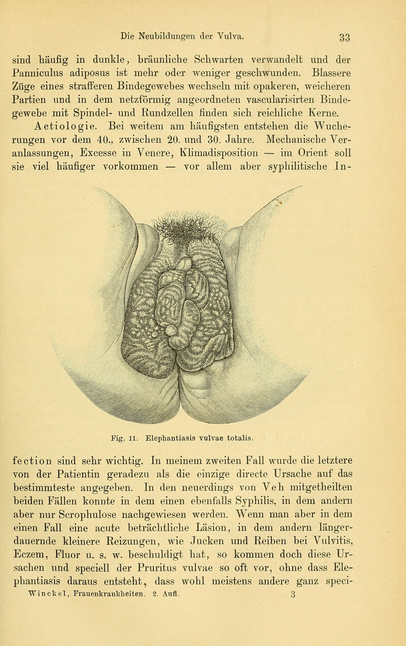 sind häufig in dunkle, bräunliche Schwarten verwandelt und der Panniculus adiposus ist mehr oder weniger geschwunden. Blassere Züge eines strafferen Bindegewebes wechseln mit opakeren, weicheren Partien und in dem netzförmig angeordneten vascularisirten Binde- gewebe mit Spindel- und Rundzellen finden sich reichliche Kerne. Aetiologie. Bei weitem am häufigsten entstehen die Wuche- rungen vor dem 40., zwischen 20. und 30. Jahre. Mechanische Ver- anlassungen, Excesse in Venere, Khmadisposition — im Orient soll sie viel häufiger vorkommen — vor allem aber syphilitische In- Fig. 11. Elephantiasis vulvae totalis. fection sind sehr wichtig. In meinem zweiten Fall wurde die letztere von der Patientin geradezu als die einzige directe Ursache auf das bestimmteste angegeben. In den neuerdings von Veh mitgetheilten beiden Fällen konnte in dem einen ebenfalls Syphilis, in dem andern aber nur Scrophulose nachgewiesen werden. Wenn man aber in dem einen Fall eine acute beträchtliche Läsion, in dem andern länger- dauernde kleinere Reizungen, wie Jucken und Reiben bei Vulvitis, Eczem, Fluor u. s. w. beschuldigt hat, so kommen doch diese Ur- sachen und speciell der Pruritus vulvae so oft vor, ohne dass Ele- phantiasis daraus entsteht, dass wohl meistens andere ganz speci- W in ekel, Frauenkrankheiten. 2. Aufl. 3