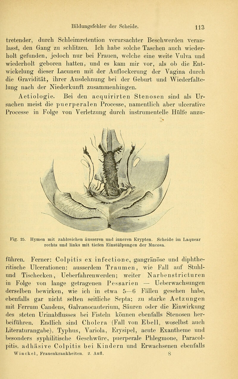 tretender, durch Schleimretention verursachter Beschwerden veran- lasst, den Gang zu schlitzen. Ich habe solche Taschen auch wieder- holt gefunden, jedoch nur hei Frauen, welche eine weite Vulva und wiederholt geboren hatten, und es kam mir vor, als ob die Ent- wickelung dieser Lacunen mit der Auflockerung der Vagina durch die Gravidität, ihrer Ausdehnung bei der Geburt und Wiederfalte- lung nach der Niederkunft zusammenhingen. Aetiologie. Bei den acquirirten Stenosen sind als Ur- sachen meist die puerperalen Processe, namentlich aber ulcerative Processe in Folge von Verletzung durch instrumenteile Hülfe anzu- Fig. 25. Hymen mit zahlreichen äusseren und inneren Krypten. Scheide im Laquear rechts und links mit tiefen Einstülpungen der Mucosa. führen. Ferner: Colpitis ex infectione, gangränöse und diphthe- ritische Ulcerationen: ausserdem Traumen, wie Fall auf Stuhl- und Tischecken, Ueberfahrenw erden; weiter Narbenstricturen in Folge von lange getragenen Pessarien — üeberwachsungen derselben bewirken, wie ich in etwa 5—6 Fällen gesehen habe, ebenfalls gar nicht selten seitliche Septa; zu starke Aetzungen mit Ferrum Candens, Galvanocauterium, Säuren oder die Einwirkung des steten Urinabflusses bei Fisteln können ebenfalls Stenosen her- beiführen. Endlich sind Cholera (Fall von Ebell, woselbst auch Literaturangabe), Typhus, Variola, Erysipel, acute Exantheme und besonders syphilitische Geschwüre, puerperale Phlegmone, Paracol- pitis, adhäsive Colpitis bei Kindern und Erwachsenen ebenfalls Win ekel, Frauenkrankheiten. 2. Aufl. 8