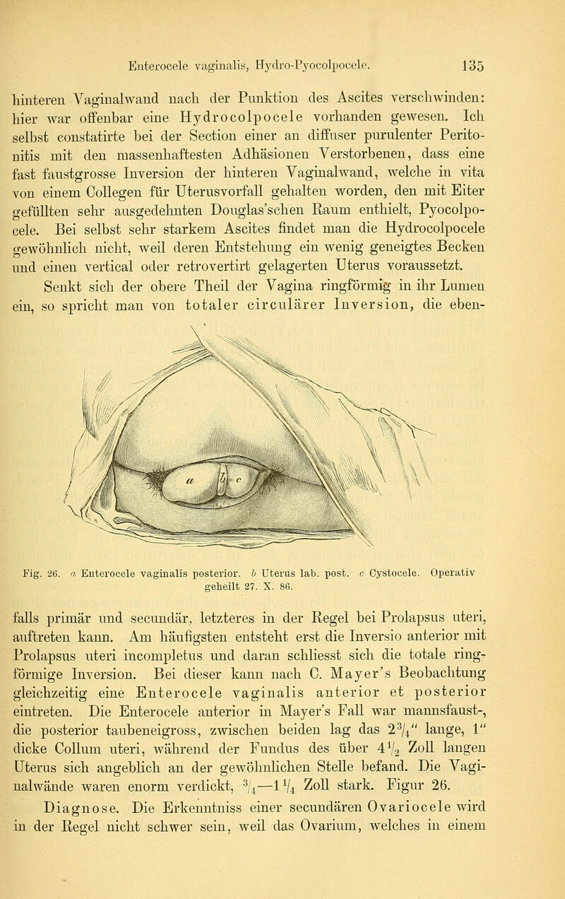 hinteren Vaginalwand nach der Punktion des Ascites verschwinden: hier war offenbar eine Hydrocolpocele vorhanden gewesen. Ich selbst constatirte bei der Section einer an diffuser purulenter Perito- nitis mit den massenhaftesten Adhäsionen Verstorbenen, dass eine fast faustgrosse Inversion der hinteren Vaginalwand, welche in vita von einem CoUegen für Uterusvorfall gehalten worden, den mit Eiter gefüllten sehr ausgedehnten Douglas'schen Raum enthielt, Pyocolpo- cele. Bei selbst sehr starkem Ascites findet man die Hydrocolpocele gewöhnlich nicht, weil deren Entstehung ein wenig geneigtes Becken und einen vertical oder retrovertirt gelagerten Uterus voraussetzt. Senkt sich der obere Theil der Vagina ringförmig in ihr Lumen ein, so spricht man von totaler circulärer Inversion, die eben- Fig. 26. a Enterocele vaginalis posterior, b Uterus lab. post. c Cystocele. Operativ geheilt 27. X. 86. falls primär und secundär, letzteres in der Regel bei Prolapsus uteri, auftreten kann. Am häufigsten entsteht erst die Inversio anterior mit Prolapsus uteri incompletus und daran schliesst sich die totale ring^ förmige Inversion. Bei dieser kann nach C. Mayer's Beobachtung gleichzeitig eine Enterocele vaginalis anterior et posterior eintreten. Die Enterocele anterior in Mayer's Fall war mannsfaust-, die posterior taubeneigross, zwischen beiden lag das 2^/4 lange, 1 dicke Collum uteri, während der Fundus des über 4^2 ZoU. laugen Uterus sich angeblich an der gewöhnlichen Stelle befand. Die Vagi- nalwände waren enorm verdickt, 3/4—IV4 ZoU stark. Figur 26. Diagnose. Die Erkenntniss einer secundären Ovariocele wird in der Regel nicht schwer sein, weil das Ovarium, welches in einem
