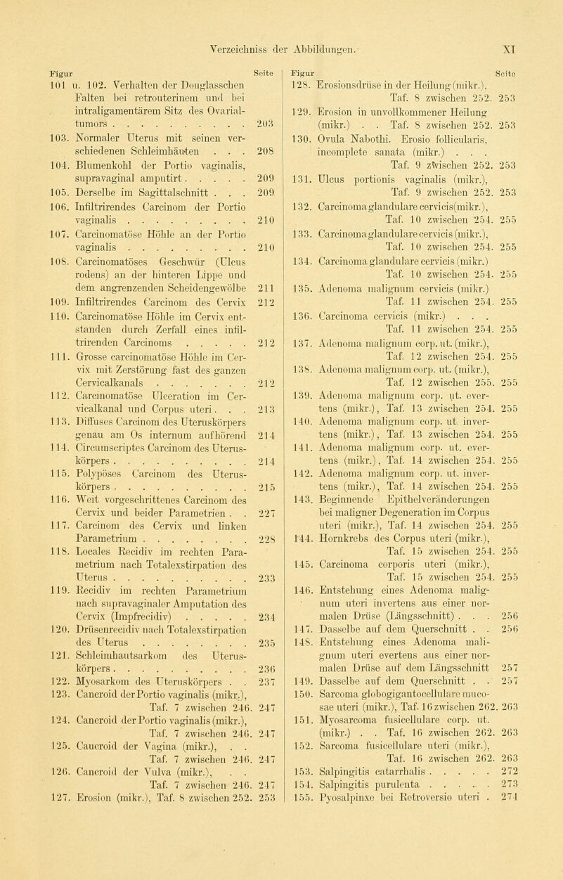 Figur Seite 101 u. 102. Verhalten der Douglasschen Falten bei retrouterinera und bei intraligamentärem Sitz des Ovarial- tumors . , 203 103. Normaler Uterus mit seinen ver- schiedenen Schleimhäu-ten . . . 208 104. Blumenkohl der Portio vaginalis, supravaginal amputirt 209 105. Derselbe im Sagittalschnitt . . . 209 106. Infiltrirendes Carcinom der Portio vaginalis 210 107. Carcinomatöse Höhle an der Portio vaginalis 210 108. Carcinomatöses Geschwür (Ulcus rodens) an der hinteren läppe und dem angrenzenden Scheidengewölbe 211 109. Infiltrirendes Carcinom des Cervix 212 110. Carcinomatöse Höhle im Cervix ent- standen durch Zerfall eines infil- trirenden Carcinoms 212 111. Grosse carcinomatöse Höhle im Cer- vix mit Zerstörung fast des ganzen Cervicalkanals 212 112. Carcinomatöse Ulceration im Cer- vicalkanal und Corpus uteri. . . 213 113. Diffuses Carcinom des Uteruskörpers genau am Os internum aufhörend 214 114. Circumscriptes Carcinom des Uterus- körpers 214 115. Polypöses Carcinom des Uterus- körpers 215 116. Weit vorgeschrittenes Carcinom des Cervix und beider Parametrien . . 227 117. Carcinom des Cervix und linken Parametrium 228 118. Locales Eecidiv im rechten Para- metrium nach Totalexstirpation des Uterus 233 119. Eecidiv im rechten Parametrium nach supravaginaler Amputation des Cervix (Impfrecidiv) 234 120. Drüsenrecidiv nach Totalexstirpation des Uterus ........ 235 121. Scbleimhautsarkom des Uterus- körpers 236 122. Myosarkom des Uteruskörpers . . 237 123. Cancroid der Portio vaginahs (mikr.), Taf. 7 zwischen 246. 247 124. Cancroid der Portio vaginahs (mikr.), Taf. 7 zwischen 246. 247 125. Caucroid der Vagina (mikr.), . . Taf. 7 zwischen 246. 247 126. Cancroid der Vulva (mikr.), . . Taf. 7 zwischen 246. 247 127. Erosion (mikr.), Taf. 8 zwischen 252. 253 Figur Seite 128. Erosionsdrüse in der Heilung (mikr.), Taf. 8 zwischen 252. 253 129. Erosion in unvollkommener Heilung (mikr.) . . Taf. S zwischen 252. 253 130. Ovula Nabothi. Erosio follicularis, incomplete sanata (mikr.) . . . Taf. 9 zwischen 252. 253 131. Ulcus portionis vaginalis (mikr.), Taf. 9 zwischen 252. 253 132. Carcinoma glanduläre cervicis(mikr.), Taf. 10 zwischen 254. 255 133. Carcinoma glanduläre cervicis (mikr.), Taf. 10 zwischen 254. 255 134. Carcinoma glanduläre cervicis (mikr.) Taf. 10 zwischen 254. 255 135. Adenoma malignum cervicis (mikr.) Taf. 11 zwischen 254. 255 136. Carcinoma cervicis (mikr.) . . . Taf. 11 zwischen 254. 255 137. Adenoma malignum corp. ut. (mikr.), Taf. 12 zwischen 254. 255 138. Adenoma malignum corp. ut. (mikr.), Taf. 12 zwischen 255. 255 139. Adenoma malignum corp. ut. ever- tens (mikr.), Taf. 13 zwischen 254. 255 140. Adenoma malignum corp. ut. inver- tens (mikr.), Taf. 13 zwischen 254. 255 141. Adenoma malignum corp. ut. ever- tens (mikr.), Taf. 14 zwischen 254. 255 142. Adenoma malignum corp. ut. inver- tens (mikr.), Taf. 14 zwischen 254. 255 143. Beginnende Epithelveränderungen bei maligner Degeneration im Corpus uteri (mikr.), Taf. 14 zwischen 254. 255 144. Hornkrebs des Corpus uteri (mikr.), Taf. 15 zwischen 254. 255 145. Carcinoma corporis uteri (mikr.), Taf. 15 zwischen 254. 255 146. Entstehung eines Adenoma malig- num uteri invertens aus einer nor- malen Drüse (Längsschnitt) . . . 256 147. Dasselbe auf dem Querschnitt . . 256 148. Entstehung eines Adenoma mali- gnum uteri evertens aus einer nor- malen Drüse auf dem Längsschnitt 257 149. Dasselbe auf dem Querschnitt . . 257 150. Sarcoma globogigantocellulare muco- sae uteri (mikr.), Taf. 16 zwischen 262. 263 151. Myosarcoma fusicellulare corp. ut. (mikr.) . . Taf. 16 zwischen 262. 263 152. Sarcoma fusicellulare uteri (mikr.), Taf. 16 zwischen 262. 263 153. Salpingitis catarrhalis 272 154. Salpingitis purulenta . . . ~ . 273 155. Pyosalpinxe bei Retroversio uteri . 274