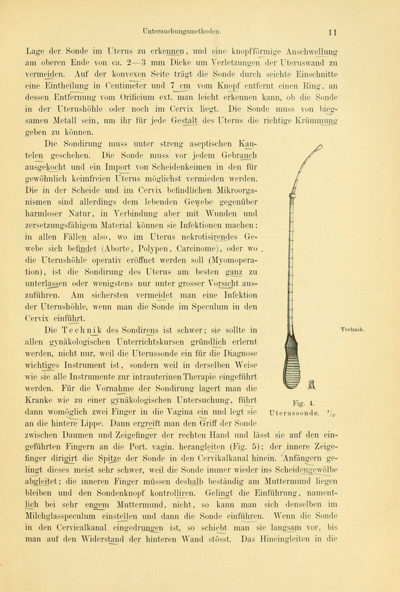 Lage der Sonde im Uterus zu erkennen, und eine knopfförmige Anschwellung am oberen Ende von ca. 2—3 mm Dicke um Verletzungen der Uteruswand zu vermeiden. Auf der konvexen Seite trägt die Sonde durch seichte Einschnitte eine Eintheilung in Centimeter und 7 cm vom Knopf entfernt einen Ring, an dessen Entfernung vom Orificium ext. man leicht erkennen kann, ob die Sonde in der Uterushöhle oder noch im Cervix liegt. Die Sonde muss von bieg- samen Metall sein, um ihr für jede Gestalt des Uterus die richtige Krümmung geben zu können. Die Sondirung muss unter streng aseptischen Kau- telen geschehen. Die Sonde muss vor jedem Gebrauch ausgekocht und ein Import von Scheidenkeimen in den für gewöhnlich keimfreien Uterus möglichst vermieden werden. Die in der Scheide und im Cervix befindlichen Mikroorga- nismen sind allerdings dem lebenden Gewebe gegenüber harmloser Natur, in Verbindung aber mit Wunden und zersetzungsfähigem Material können sie Infektionen machen; in allen Fällen_ also, wo im Uterus nekrotisirendes Ge- webe sich befinclet (Aborte, Polypen, Carcinome), oder wo die Uterushöhle operativ eröffnet werden soll (Myomopera- tion), ist die Sondirung des Uterus am besten ganz zu unterlassen oder wenigstens nur unter grosser Vorsicht aus- zuführen. Am sichersten vermeidet man eine Infektion der Uterushöhle, wenn man die Sonde im Speculum in den Cervix einführt. Die Technik des Sondirens ist schwer; sie sollte in allen g3rnäkologischen Unterrichtskursen gründlich erlernt werden, nicht nur, weil die Uterussonde ein für die Diagnose wichtiges Instrument ist, sondern weil in derselben Weise wie sie alle Instrumente zur intrauterinen Therapie eingeführt werden. Für die Vornahme der Sondirung lagert man die Kranke wie zu einer gynäkologischen Untersuchung, führt dann womöglich zwei Finger in die Vagina ein und legt sie an die hintere Lippe. Dann ergreift man den Griff der Sonde zwischen Daumen und Zeigefinger der rechten Hand und lässt sie auf den ein- geführten Fingern an die Port, vagin. herangleiten (Fig. 5); der innere Zeige- finger dirigirt die Spitze der Sonde in den Cervikalkanal hinein. Anfängern ge- lingt dieses meist sehr schwer, weil die Sonde immer wieder ins Scheidengewölbe abgleitet; die inneren Finger müssen deshalb beständig am Muttermund liegen bleiben und den Sondenknopf kontrolliren. Gelingt die Einführung, nament- lich bei sehr engem Muttermund, nicht, so kann man sich denselben im Milchglasspeculum einstellen und dann die Sonde einführen. Wenn die Sonde in den Cervicalkanal eingedrungen ist, so schiebt man sie langsam vor, bis man auf den Widerstand der hinteren Wand stösst. Das Hineingleiten in die Technik. Fig. 4. Uterussonde.