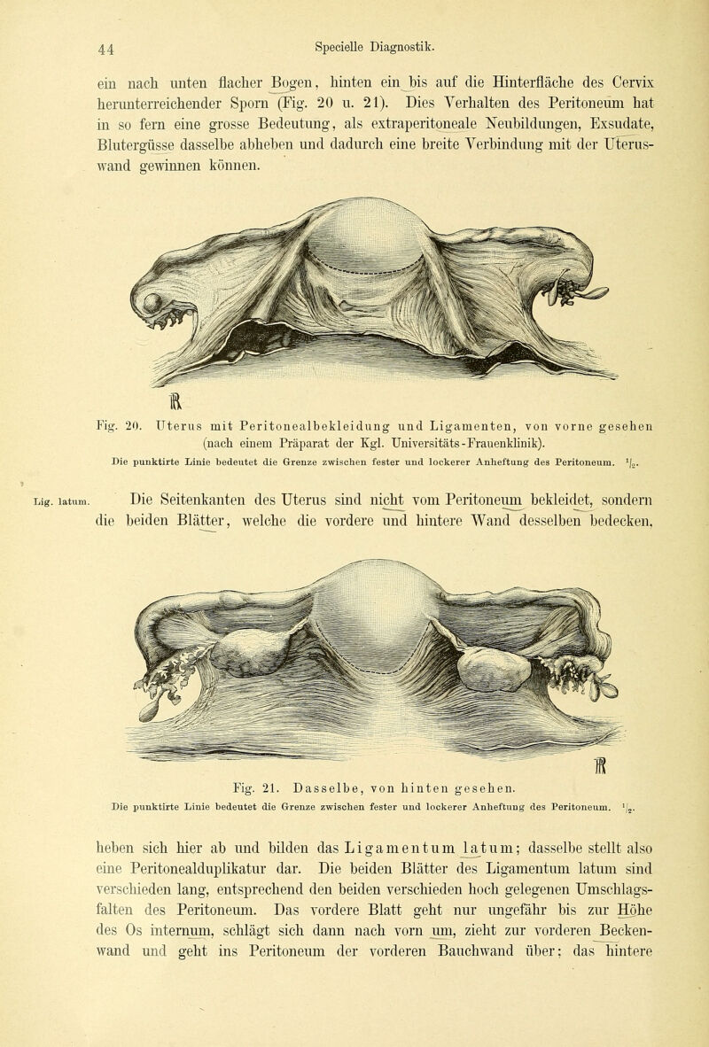 ein nach unten flacher Bogen, hinten ein_bis auf die Hinterfläche des Cervix herunterreichender Sporn (Fig. 20 u. 21). Dies Verhalten des Peritoneum hat in so fern eine grosse Bedeutung, als extraperitoneale Neubildungen, Exsudate, Blutergüsse dasselbe abheben und dadurch eine breite Verbindung mit der Uterus- wand gewinnen können. Fig. 20. Uterus mit Peritonealbekleidung und Ligamenten, von vorne gesehen (nach einem Präparat der Kgl. Universitäts-Frauenklinik). Die pimktirte Linie bedeutet die Grenze zwischen fester und lockerer Anheftung des Peritoneum. 1/2. Lig. latum. Die Seitenkanten des Uterus sind nicht vom Peritoneum bekleidet, sondern die beiden Blätter, welche die vordere und hintere Wand desselben bedecken. Fig. 21. Dasselbe, von hinten gesehen. Die punktirte Linie bedeutet die Grenze zwischen fester und lockerer Anheftung des Peritoneum. heben sich hier ab und bilden das Ligamentum latum; dasselbe stellt also eine Peritonealduplikatur dar. Die beiden Blätter des Ligamentum latum sind verschieden lang, entsprechend den beiden verschieden hoch gelegenen Umschlags- falten des Peritoneum. Das vordere Blatt geht nur ungefähr bis zur Höhe des Os mternum, schlägt sich dann nach vorn um, zieht zur vorderen Becken- wand und geht ins Peritoneum der vorderen Bauchwand über; das hintere