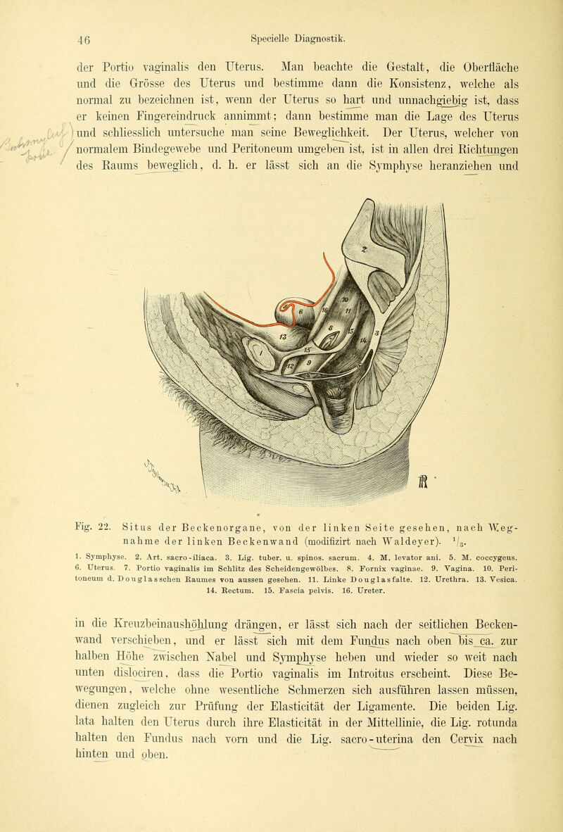 der Portio vaginalis den Uterus. Man beachte die Gestalt, die Oberfläche und die Grösse des Uterus und bestimme dann die Konsistenz, welche als normal zu bezeichnen ist, wenn der Uterus so hart und unnachgiebig ist, dass er keinen Fingereindruck annimmt; dann bestimme man die Lage des Uterus /und schliesslich untersuche man seine Beweglichkeit. Der Uterus, welcher von normalem Bindegewebe und Peritoneum umgeben ist, ist in allen drei Richtungen des Raums beweglich, d. h. er lässt sich an die Symphyse heranziehen und Fig. 22. Situs der Beckenorgane, von der linken Seite gesehen, nach Weg- nahme der linken Beckenwand (modifizirt nach Waldeyer). 1IS. 1. Symphyse. 2. Art. sacro-iliaca. 3. Lig. tuber. u. spinös, sacrum. 4. M. levator ani. 5. M. coccygeus. 6. Uterus. 7. Portio vaginalis im Schlitz des Scheidengewölbes. 8. Fornix vaginae. 9. Vagina. 10. Peri- toneum d. Douglasschen Kaumes von aussen gesehen. 11. Linke Douglasfalte. 12. Urethra. 13. Vesica. 14. Eectum. 15. Fascia peivis. 16. Ureter. in die Kreuzbeinaushöhlung drängen, er lässt sich nach der seitlichen Becken- wand verschieben, und er lässt sich mit dem Fundus nach oben bis_ca. zur halben Höhe zwischen Nabel und Symphyse heben und wieder so weit nach unten dislociren, dass die Portio vaginalis im Introitus erscheint. Diese Be- wegungen, welche ohne wesentliche Schmerzen sich ausführen lassen müssen, dienen zugleich zur Prüfung der Elasticität der Ligamente. Die beiden Lig. lata halten den Uterus durch ihre Elasticität in der Mittellinie, die Lig. rotunda halten den Fundus nach vorn und die Lig. sacro - uterina den Ceryix nach hinten und oben.