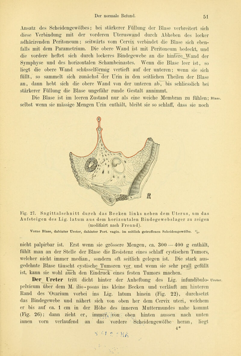 Ansatz des Scheidengewölbes; bei stärkerer Füllung der Blase verbreitert sich diese Verbindung mit der vorderen Uteruswand durch Abheben des locker adhärirenden Peritoneum; seitwärts vom Cervix verbindet die Blase sich eben- falls mit dem Parametrium. Die obere Wand ist mit Peritoneum bedeckt, und die vordere heftet sich durch lockeres Bindegewebe an die hiniere^Wand der Symphyse und des horizontalen Schambeinastes. Wenn die Blase leer ist, so liegt die obere Wand schüsseiförmig vertieft auf der unteren; wenn sie sich füllt, so sammelt sich zunächst der Urin in den seitlichen Theilen der Blase an, dann hebt sich die obere Wand von der unteren ab, bis schliesslich bei stärkerer Füllung die Blase ungefähr runde Gestalt annimmt. Die Blase ist im leeren Zustand nur als eine weiche Membran zu fühlen; Blase, selbst wenn sie massige Mengen Urin enthält, bleibt sie so schlaff, dass sie noch Fig. 27. Sagittalschnitt durch das Becken links neben dem Uterus, um das Aufsteigen des Lig. latum aus dem horizontalen Bindegewebslager zu zeigen (modifizirt nach Freund). Vorne Blase, dahinter Ureter, dahinter Port, vagin. im seitlich getroffenen Scheidenge-wölhe. 1/3. nicht palpirbar ist. Erst wenn sie grössere Mengen, ca. 300 — 400 g enthält, fühlt man an der Stelle der Blase die Resistenz eines schlaff cystischen Tumors, welcher nicht immer median, sondern oft seitlich gelegen ist. Die stark aus- gedehnte Blase täuscht cystische Tumoren vor_ und wenn sie sehr prall gefüllt ist, kann sie wohl auch den Eindruck eines festen Tumors machen. Der Ureter tritt dicht hinter der Anheftung des Lig. infundibulo- Ureter. pelvicum über dem M. ilio-psoas ins kleine Becken und verläuft am hinteren Rand des Ovarium vorbei ins Lig. latum hinein (Fig. 22), durchsetzt das Bindegewebe und nähert sich von oben her dem Cervix uteri, welchem er bis auf ca. 1 cm in der Höhe des inneren Muttermundes nahe kommt (Fig. 26); dann zieht er, immer.; ivon; oben hinten aussen nach unten innen vorn verlaufend an das vordere Scheidengewölbe heran, liegt < <-\ \i\