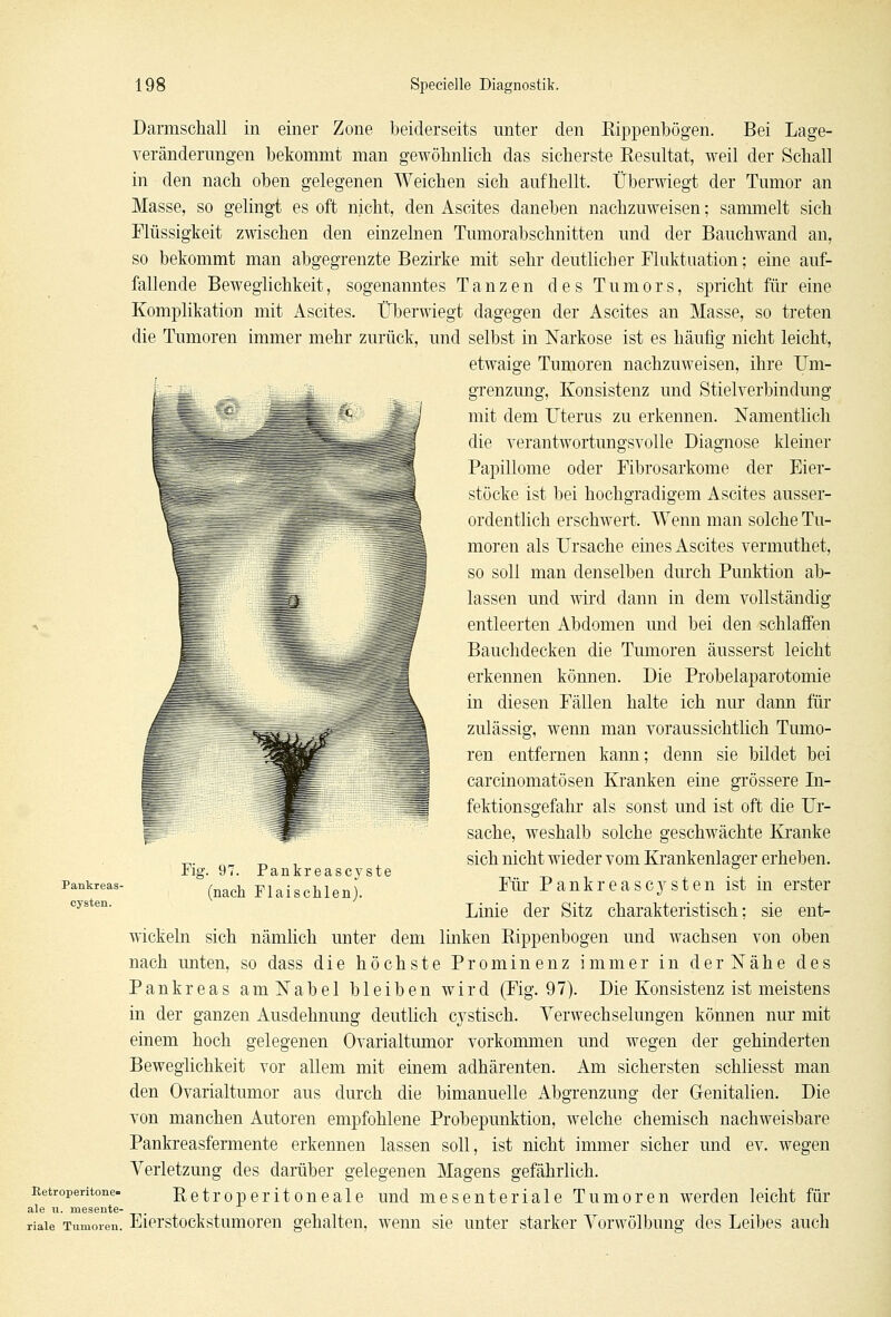 Darmschall in einer Zone beiderseits unter den Rippenbögen. Bei Lage- veränderungen bekommt man gewöhnlich das sicherste Resultat, weil der Schall in den nach oben gelegenen Weichen sich aufhellt. Überwiegt der Tumor an Masse, so gelingt es oft nicht, den Ascites daneben nachzuweisen; sammelt sich Flüssigkeit zwischen den einzelnen Tumorabschnitten und der Bauchwand an, so bekommt man abgegrenzte Bezirke mit sehr deutlicher Fluktuation; eine auf- fallende Beweglichkeit, sogenanntes Tanzen des Tumors, spricht für eine Komplikation mit Ascites. Überwiegt dagegen der Ascites an Masse, so treten die Tumoren immer mehr zurück, und selbst in Narkose ist es häufig nicht leicht, etwaige Tumoren nachzuweisen, ihre Um- grenzung, Konsistenz und Stielverbindung mit dem Uterus zu erkennen. Namentlich die verantwortungsvolle Diagnose kleiner Papillome oder Fibrosarkome der Eier- stöcke ist bei hochgradigem Ascites ausser- ordentlich erschwert. Wenn man solche Tu- moren als Ursache eines Ascites vermuthet, so soll man denselben durch Punktion ab- lassen und wird dann in dem vollständig entleerten Abdomen und bei den schlaffen Bauchdecken die Tumoren äusserst leicht erkennen können. Die Probelaparotomie in diesen Fällen halte ich nur dann für zulässig, wenn man voraussichtlich Tumo- ren entfernen kann; denn sie bildet bei carcinomatösen Kranken eine grössere In- fektionsgefahr als sonst und ist oft die Ur- sache, weshalb solche geschwächte Kranke sich nicht wieder vom Krankenlager erheben. Für Pankreascysten ist in erster Linie der Sitz charakteristisch; sie ent- wickeln sich nämlich unter dem linken Rippenbogen und wachsen von oben nach unten, so dass die höchste Prominenz immer in der Nähe des Pankreas am Nabel bleiben wird (Fig. 97). Die Konsistenz ist meistens in der ganzen Ausdehnung deutlich C3Tstisch. Verwechselungen können nur mit einem hoch gelegenen Ovarialtumor vorkommen und wegen der gehinderten Beweglichkeit vor allem mit einem adhärenten. Am sichersten schliesst man den Ovarialtumor aus durch die bimanuelle Abgrenzung der Genitalien. Die von manchen Autoren empfohlene Probepunktion, welche chemisch nachweisbare Pankreasfermente erkennen lassen soll, ist nicht immer sicher und ev. wegen Verletzung des darüber gelegenen Magens gefährlich. Eetroperitone- Retroperitoneale und mesenteriale Tumoren werden leicht für ale u. mesente- riale Tumoren. Eierstockstumoren gehalten, wenn sie unter starker Vorwölbung des Leibes auch Pankreas- cysten. Fig. 97. Pankreascyste (nach Flaischlen).