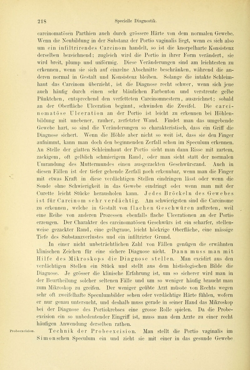 carcinomatösen Parthien auch durch grössere Härte von dem normalen Gewebe. Wenn die Neubildung in der Substanz der Portio vaginalis liegt, wenn es sich also um ein infiltrirendes Carcinom handelt, so ist die knorpelharte Konsistenz derselben bezeichnend; zugleich wird die Portio in ihrer Form verändert, sie wird breit, plump und unförmig. Diese Veränderungen sind am leichtesten zu erkennen, wenn sie sich auf einzelne Abschnitte beschränken, während die an- deren normal in Gestalt und Konsistenz bleiben. Solange die intakte Schleim- haut das Carcinom überzieht, ist die Diagnose recht schwer, wenn sich jene auch häufig durch einen sehr bläulichen Farbenton und verstreute gelbe Pünktchen, entsprechend den verfetteten Carcinomnestern, auszeichnet; sobald an der Oberfläche Ulceration beginnt, schwinden die Zweifel. Die car'ci- nomatöse Ulceration an der Portio ist leicht zu erkennen bei Höhlen- bildung mit unebener, rauher, zerfetzter Wand. Findet man das umgebende Gewebe hart, so sind die Veränderungen so charakteristisch, dass ein Griff die Diagnose sichert. Wenn die Höhle aber nicht so weit ist, dass sie den Finger aufnimmt, kann man doch den beginnenden Zerfall schon im Speculum erkennen. An Stelle der glatten Schleimhaut der Portio sieht man dann Risse mit zartem, zackigem, oft gelblich schmierigem Rand, oder man sieht statt der normalen Umrandung des Muttermundes einen ausgezackten Geschwürsrand. Auch in diesen Fällen ist der tiefer gehende Zerfall poch erkennbar, wenn man die Finger mit etwas Kraft in diese verdächtigen Stellen eindringen lässt oder wenn die Sonde ohne Schwierigkeit in das Gewebe eindringt oder wenn man mit der Curette leicht Stücke herausholen kann. Jedes Bröckeln des Gewebes ist für Carcinom sehr verdächtig. Am schwierigsten sind die Carcinome zu erkennen, welche in Gestalt von flachen Geschwüren auftreten, weil eine Reihe von anderen Prozessen ebenfalls flache Ulcerationen an der Portio erzeugen. Der Charakter des carcinomatösen Geschwürs ist ein scharfer, stellen- weise gezackter Rand, eine gelbgrane, leicht höckrige Oberfläche, eine massige Tiefe des Substanzverlustes und ein infiltrirter Grund. In einer nicht unbeträchtlichen Zahl von Fällen genügen die erwähnten klinischen Zeichen für eine sichere Diagnose nicht. Dann muss man mit Hilfe des Mikroskops die Diagnose stellen. Man excidirt aus den verdächtigen Stellen ein Stück und stellt aus dem histologischen Bilde die Diagnose. Je grösser die klinische Erfahrung ist, um so sicherer wird man in der Beurtheilung solcher seltenen Fälle und um so weniger häufig braucht man zum Mikroskop zu greifen. Der weniger geübte Arzt müsste von Rechts wegen sehr oft zweifelhafte Speculumbilder sehen oder verdächtige Härte fühlen, wofern er nur genau untersucht, und deshalb muss gerade in seiner Hand das Mikroskop bei der Diagnose des Portiokrebses eine grosse Rolle spielen. Da die Probe- excision ein so unbedeutender Eingriff ist, muss man dem Arzte zu einer recht häufigen Anwendung derselben rathen. piobeexcision. Technik der Probe ex cision. Man stellt die Portio vaginalis im Simon sehen Speculum ein und zieht sie mit einer in das gesunde Gewebe