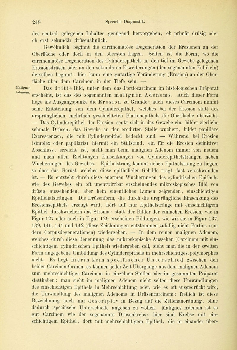 des central gelegenen Inhaltes genügend hervorgehen, ob primär drüsig oder ob erst sekundär drüsenähnlich. Gewöhnlich beginnt die carcinomatöse Degeneration der Erosionen an der Oberfläche oder doch in den obersten Lagen. Selten ist die Form, wo die carcinomatöse Degeneration des Cylinderepithels an den tief im Gewebe gelegenen Erosionsdrüsen oder an den sekundären Erweiterungen (den sogenannten Follikeln) derselben beginnt: hier kann eine gutartige Veränderung (Erosion) an der Ober- fläche über dem Carcinom in der Tiefe sein. — Malignes Das d r i 11 e Bild, unter dem das Portiocarcinom im histologischen Präparat ' erscheint, ist das des sogenannten malignen Adenoms. Auch dieser Form liegt als Ausgangspunkt die Erosion zu Grunde: auch dieses Carcinom nimmt seine Entstehung von dem Cylinderepithel, welches bei der Erosion statt des ursprünglichen, mehrfach geschichteten Plattenepithels die Oberfläche überzieht. — Das Cylinderepithel der Erosion senkt sich in das Gewebe ein, bildet zierliche schmale Drüsen, das Gewebe an der erodirten Stelle wuchert, bildet papilläre Excrescenzen, die mit Cylinderepithel bedeckt sind. — Während bei Erosion (simplex oder papillaris) hiermit ein Stillstand, ein für die Erosion definitiver Abschluss, erreicht ist, sieht man beim malignen Adenom immer von neuem und nach allen Richtungen Einsenkungen von Cylinderepithelsträngen neben Wucherungen des Gewebes. Epithelstrang kommt neben Epithelstrang zu liegen, so dass das Gerüst, welches diese epithelialen Gebilde trägt, fast verschwunden ist. — Es entsteht durch diese enormen Wucherungen des cylindrischen Epithels, wie des Gewebes ein oft unentwirrbar erscheinendes mikroskopisches Bild von drüsig aussehenden, aber kein eigentliches Lumen zeigenden, einschichtigen Epithelialsträngen. Die Drüsenform, die durch die ursprüngliche Einsenkung des Erosionsepithels erzeugt wird, hört auf, nur Epithelstränge mit einschichtigem Epithel durchwuchern das Stroma: statt der Bilder der einfachen Erosion, wie in Figur 127 oder auch in Figur 129 erscheinen Bildungen, wie wir sie in Figur 137, 139, 140, 141 und 142 (diese Zeichnungen entstammen zufällig nicht Portio-, son- dern Corpusdegenerationen) wiedergeben. — In dem reinen malignen Adenom, welches durch diese Benennung das mikroskopische Aussehen (Carcinom mit ein- schichtigem cylindrischen Epithel) wiedergeben soll, sieht man die in der zweiten Form angegebene Umbildung des Cylinderepithels in mehrschichtiges, polymorphes nicht. Es liegt hierin kein specifischer Unterschied zwischen den beiden Carcinomformen, es können jeder Zeit Übergänge aus dem malignen Adenom zum mehrschichtigen Carcinom in einzelnen Stellen oder im gesammten Präparat statthaben: man sieht im malignen Adenom nicht selten diese Umwandlungen des einschichtigen Epithels in Mehrschichtung oder, wie es oft ausgedrückt wird, die Umwandlung des malignen Adenoms in Drüsencarcinom: freilich ist diese Bezeichnung auch nur descriptiv in Bezug auf die Zellenanordnung, ohne dadurch specifische Unterschiede angeben zu wollen. Malignes Adenom ist so gut Carcinom wie der sogenannte Drüsenkrebs; hier sind Krebse mit ein- schichtigem Epithel, dort mit mehrschichtigem Epithel, die in einander über-