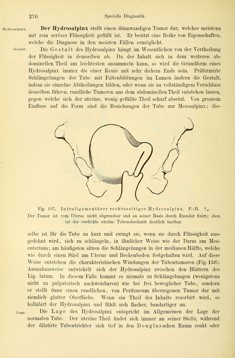 Gestalt. Hydrosaipinx. Der Hydrosaipinx stellt einen dünnwandigen Tumor dar, welcher meistens mit rein seröser Flüssigkeit gefüllt ist. Er besitzt eine Keine von Eigenschaften, welche die Diagnose in den meisten Fällen ermöglicht. Die Gestalt des Hydrosaipinx hängt im Wesentlichen von der Vertheilung der Flüssigkeit in demselben ab. Da der Inhalt sich in dem weiteren ab- dominellen Theil am leichtesten ansammeln kann, so wird die Grundform eines Hydrosaipinx immer die einer Keule mit sehr dickem Ende sein. Präformirte Schlängelungen der Tube mit Faltenbildungen im Lumen ändern die Gestalt, indem sie einzelne Abtheilungen bilden, oder wenn sie zu vollständigem Verschluss desselben führen, rundliche Tumoren aus dem abdominellen Theil entstehen lassen, gegen welche sich der uterine, wenig gefüllte Theil scharf absetzt. Von grossem Einfluss auf die Form sind die Beziehungen der Tube zur Mesosalpinx; die- Fig. 157. Intraligainentärer rechtsseitiger Hydrosaipinx. P.-B. 1/8. Der Tumor ist vom Uterus nicht abgrenzbar und an seiner Basis durch Exsudat fixirt; oben ist der verdickte uterine Tubenabschnitt deutlich tastbar. Lage. selbe ist für die Tube zu kurz und zwingt sie, wenn sie durch Flüssigkeit aus- gedehnt wird, sich zu schlängeln, in ähnlicher Weise wie der Darm am Mes- enterium ; am häufigsten sitzen die Schlängelungen in der medianen Hälfte, welche wie durch einen Stiel am Uterus und Beckenboden festgehalten wird. Auf diese Weise entstehen die charakteristischen Windungen der Tubentumoren (Fig. 156). Ausnahmsweise entwickelt sich der Hydrosaipinx zwischen den Blättern des Lig. latum. In diesem Falle kommt es niemals zu Schlängelungen (wenigstens nicht zu palpatorisch nachweisbaren) wie bei frei beweglicher Tube, sondern er stellt dann einen rundlichen, von Peritoneum überzogenen Tumor dar mit ziemlich- glatter Oberfläche. Wenn ein Theil des Inhalts resorbirt wird, so kollabirt -der Hydrosaipinx und fühlt sich flacher, bandartiger an. Die Lage des Hydrosaipinx entspricht im Allgemeinen der Lage der normalen Tube. Der uterine Theil findet sich immer an seiner Stelle, während der dilatirte Tubentrichter sich tief in den Douglas sehen Raum senkt oder