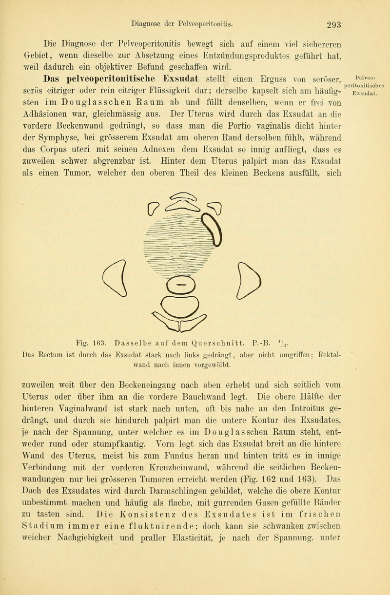 Die Diagnose der Pelveoperitonitis bewegt sich auf einem viel sichereren Gebiet, wenn dieselbe zur Absetzung eines Entzündungsproduktes geführt hat, weil dadurch ein objektiver Befund geschaffen wird. Das pelveoperitonitische Exsudat stellt einen Erguss von seröser, ^lveo- serös eitriger oder rein eitriger Flüssigkeit dar; derselbe kapselt sich am häufig- Exsudat. sten im Douglasschen Raum ab und füllt denselben, wenn er frei von Adhäsionen war, gleichmässig aus. Der Uterus wird durch das Exsudat an die vordere Beckenwand gedrängt, so dass man die Portio vaginalis dicht hinter der Symphyse, bei grösserem Exsudat am oberen Rand derselben fühlt, während das Corpus uteri mit seinen Adnexen dem Exsudat so innig aufliegt, dass es zuweilen schwer abgrenzbar ist. Hinter dem Uterus palpirt man das Exsudat als einen Tumor, welcher den oberen Theil des kleinen Beckens ausfüllt, sich pAfl <^ Fig. 163. Dasselbe auf dem Querschnitt. P.-B. 1/3. Das Eectum ist durch das Exsudat stark nach links gedrängt, aber nicht umgriffen; Kektal- wand nach innen vorgewölbt. zuweilen weit über den Beckeneingang nach oben erhebt und sich seitlich vom Uterus oder über ihm an die vordere Bauchwand legt. Die obere Hälfte der hinteren Vaginalwand ist stark nach unten, oft bis nahe an den Introitus ge- drängt, und durch sie hindurch palpirt man die untere Kontur des Exsudates, je nach der Spannung, unter welcher es im Douglasschen Raum steht, ent- weder rund oder stumpfkantig. Vorn legt sich das Exsudat breit an die hintere Wand des Uterus, meist bis zum Fundus heran und hinten tritt es in innige Verbindung mit der vorderen Kreuzbeinwand, während die seitlichen Becken- wandungen nur bei grösseren Tumoren erreicht werden (Fig. 162 und 163). Das Dach des Exsudates wird durch Darmschlingen gebildet, welche die obere Kontur unbestimmt machen und häufig als flache, mit gurrenden Gasen gefüllte Bänder zu tasten sind. Die Konsistenz des Exsudates ist im frischen Stadium immer eine fluktuirende; doch kann sie schwanken zwischen weicher Nachgiebigkeit und praller Elasticität, je nach der Spannung, unter
