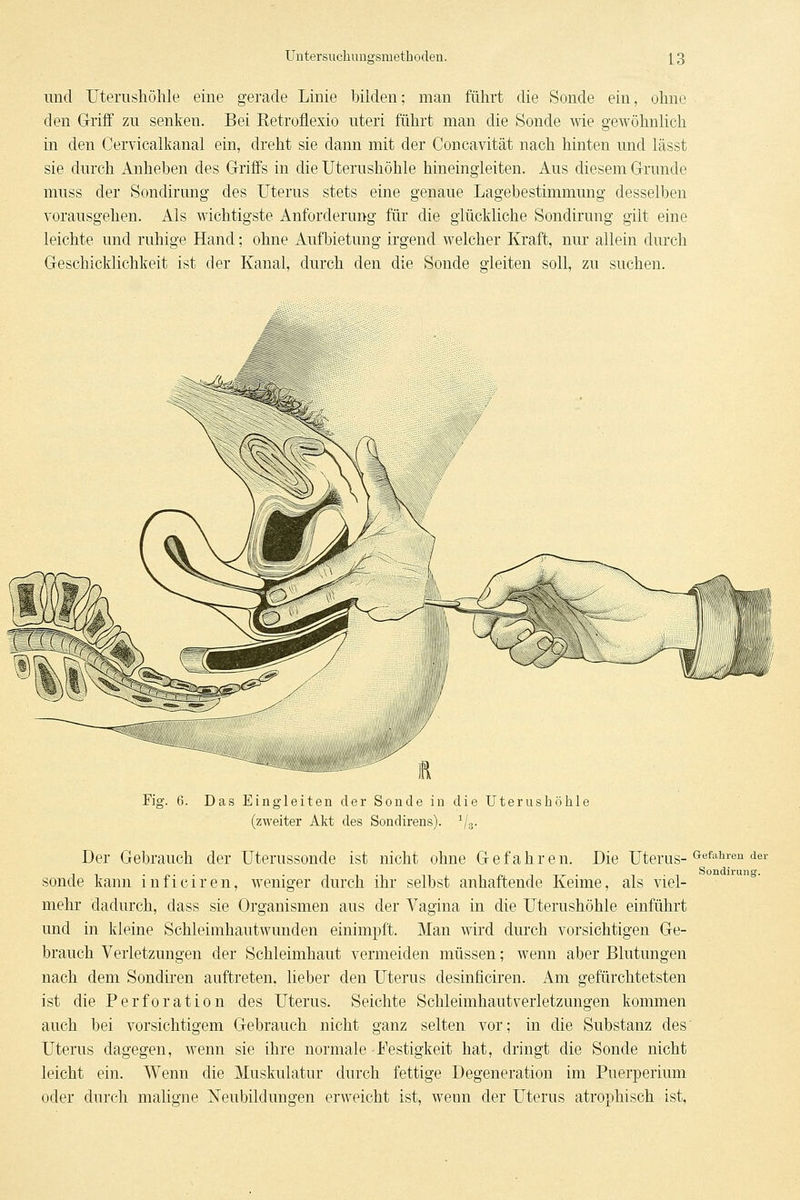 und TJterushöhle eine gerade Linie bilden; man führt die Sonde ein, ohne den Griff zu senken. Bei Retroflexio uteri führt man die Sonde wie gewöhnlich in den Cervicalkanal ein, dreht sie dann mit der Concavität nach hinten und lässt sie durch Anheben des Griffs in die Uterushöhle hineingleiten. Aus diesem Grunde muss der Sondirung des Uterus stets eine genaue Lagebestimmung desselben vorausgehen. Als wichtigste Anforderung für die glückliche Sondirung gilt eine leichte und ruhige Hand; ohne Aufbietung irgend welcher Kraft, nur allein durch Geschicklichkeit ist der Kanal, durch den die Sonde gleiten soll, zu suchen. Fig. 6. Das Eingleiten der Sonde in die Uteriishöhle (zweiter Akt des Sondirens). ^/g. Der Gebrauch der Uterussonde ist nicht ohne Gefahren. Die Uterus-^•'^'''''^'^'i^^' sende kann inficiren, weniger durch ihr selbst anhaftende Keime, als viel- mehr dadurch, dass sie Organismen aus der Vagina in die Uterushöhle einführt und in kleine Schleimhautwunden einimpft. Man wird durch vorsichtigen Ge- brauch Verletzungen der Schleimhaut vermeiden müssen; wenn aber Blutungen nach dem Sondiren auftreten, lieber den Uterus desinficiren. Am gefürchtetsten ist die Perforation des Uterus. Seichte Schleimhautverletzungen kommen auch bei vorsichtigem Gebrauch nicht ganz selten vor; in die Substanz des Uterus dagegen, wenn sie ihre normale Festigkeit hat, dringt die Sonde nicht leicht ein. Wenn die Muskulatur durch fettige Degeneration im Puerperium oder durch maligne Neubildungen erweicht ist, wenn der Uterus atrophisch ist,