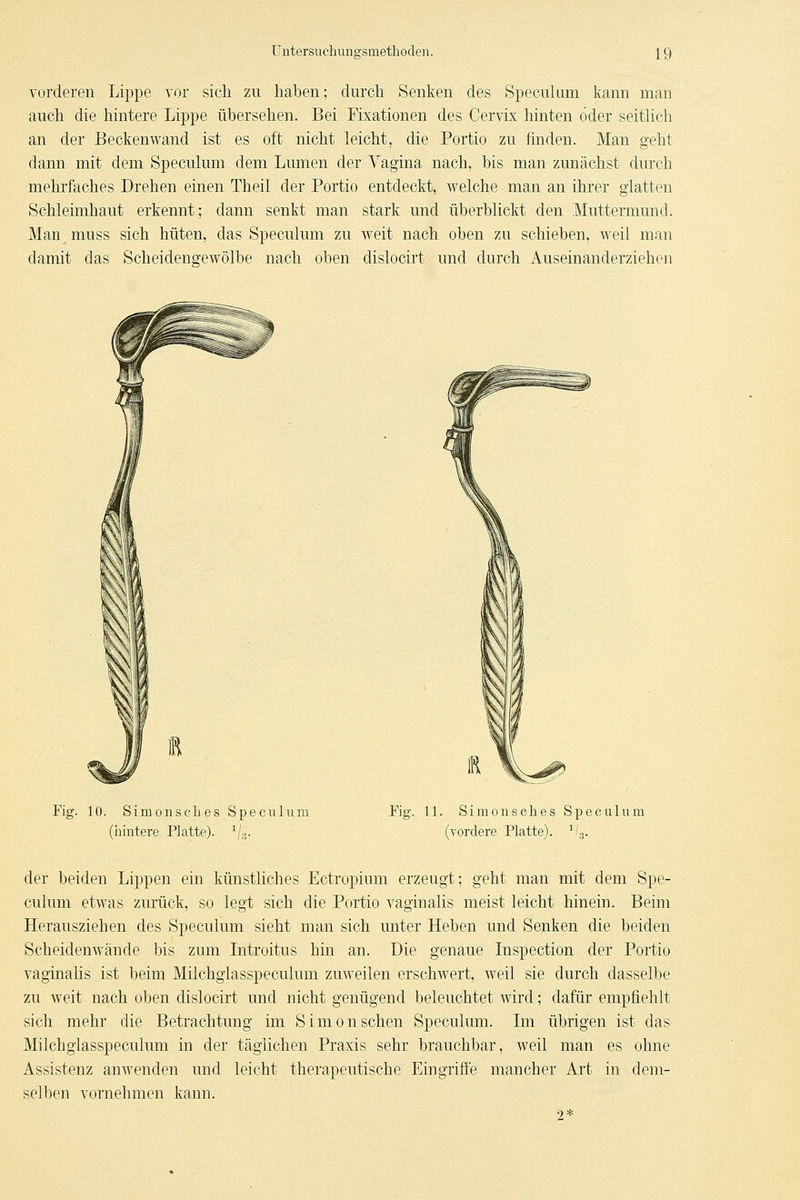 vorderen Lippe vor sich zu haben; durch Senken des Speculum kann man auch die hintere Lippe übersehen. Bei Fixationen des Cervix hinten öder seitHch an der Beckenwand ist es oft nicht leicht, die Portio zu finden. Man geht dann mit dem Speculum dem Lumen der Vagina nach, bis man zunächst durch mehrfaches Drehen einen Theil der Portio entdeckt, welche man an ihrer glatten Schleimhaut erkennt; dann senkt man stark und überblickt den Muttermund. Man muss sich hüten, das Speculum zu weit nach oben zu schieben, weil man damit das Scheidensrewölbe nach oben dislocirt und durch Auseinanderziehen Fig. 10. Simonscbes Speculum (hintere Platte). Vr- Fig. 11. Simonscbes Speculum (vordere Platte), ^/g. der beiden Lippen ein künstliches Ectropium erzeugt; geht man mit dem Spe- culum etwas zurück, so legt sich die Portio vaginalis meist leicht hinein. Beim Herausziehen des Speculum sieht man sich unter Heben und Senken die beiden Scheidenwände bis zum Litroitus hin an. Die genaue Inspection der Portio vaginalis ist beim Milchgiasspeculum zuweilen erschwert, weil sie durch dasselbe zu weit nach oben dislocirt und nicht genügend beleuchtet wird; dafür empfiehlt sich mehr die Betrachtung im Simon sehen Speculum. Im übrigen ist das Milchgiasspeculum in der täglichen Praxis sehr brauchbar, weil man es ohne Assistenz anwenden und leicht therapeutische Eingriffe mancher Art in dem- selben vornehmen kann. 2*