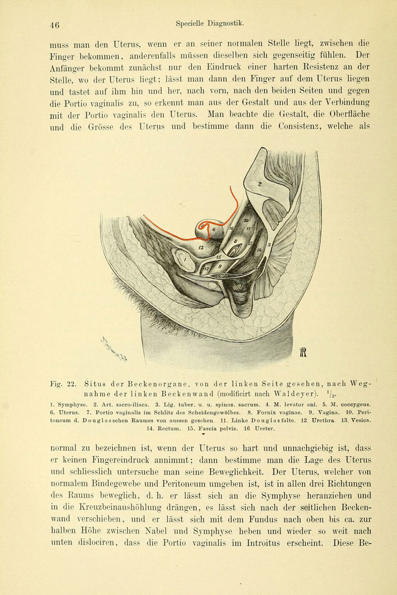 muss man den Uterus, wenn er an seiner normalen Stelle liegt, zwischen die Finger bekommen, anderenfalls müssen dieselben sich gegenseitig fühlen. Der Anfänger bekommt zunächst nur den Eindruck einer harten Resistenz an der Stelle, wo der Uterus liegt; lässt man dann den Finger auf dem Uterus liegen und tastet auf ihm hin und her, nach vom, nach den beiden Seiten und gegen die Portio vaginalis zu, so erkennt man aus der Gestalt und aus der Verbindung mit der Portio vaginalis den Uterus. Man beachte die Grestalt, die Oberfläche und die Grösse des Uterus und bestimme dann die Consistenz, welche als Fig. 22. Situs der Beckenorgane, von der linken Seite gesehen, nach Weg- nahme der linken Beckenwand (raodificirt nach Waldeyer). ^/g. 1. Sympliyse. 2. Art. sacro-üiaca. 3. Iiig. tuber. u. u. spinös, sacrum. 4. M. levator ani. 5. M. coccygeus. 6. Uterus. 7. Portio vaginalis im Schlitz des Scheidengewölbes. 8. Fornix vaginae. 9. Vagina. 10. Peri- toneum d. Douglasschen Eaumes von aussen gesehen. 11. Linke Douglasfalte. 12. Urethra. 13. Vesica. 14. Eectum. 15. Fascia pelvis. 16 Ureter. normal zu bezeichnen ist, wenn der Uterus so hart und unnachgiebig ist, dass er keinen Fingereindruck annimmt; dann bestimme man die Lage des Uterus und schliesslich untersuche man seine Beweglichkeit. Der Uterus, welcher von normalem Bindegewebe und Peritoneum umgeben ist, ist in allen drei Eichtungen des Raums beweglich, d. h. er lässt sich an die Symphyse heranziehen und in die Kreuzbeinaashöhlung drängen, es lässt sich nach der seitlichen Becken- wand verschieben, und er lässt sich mit dem Fundus nach oben bis ca. zur halben Höhe zwischen Nabel und Symphyse heben und wieder so weit nach unten dislociren, dass die Portio vaginalis im Introitus erscheint. Diese Be-