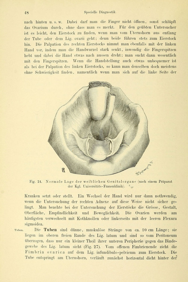 nach hinten u. s. w. Dabei darf man die Finger nicht offnen, sonst schlüpft das Ovarium durch, ohne dass man es merkt. Für den geübten TJntersucher ist es leicht, den Eierstock zu finden, wenn man vom Uterushorn aus entlang der Tube oder dem Lig. ovarii geht; denn beide führen stets zum Eierstock hin. Die Palpation des rechten Eierstocks nimmt man ebenfalls mit der linken Hand vor, indem man die Handwurzel stark senkt, inwendig die Fingerspitzen hebt und dabei die Hand etwas nach aussen dreht; man sucht dann wesentlich mit den Fingerspitzen. Wenn die Handstellung auch etwas unbequemer ist als bei der Palpation des linken Eierstocks, so kann man denselben doch meistens ohne Schwierigkeit finden, namentlich wenn man sich auf die linke Seite der Fig. 24. Normale Lage der weiblichen Genitalorgane (nach einem Präparat der Kgl. Universitäts-Frauenklinik). Va- Kranken setzt oder stellt. Ein Wechsel der Hand wird nur dann nothwendig, ■ wenn die Untersuchung der rechten Adnexe auf diese Weise nicht sicher ge- lingt. Man beachte bei der Untersuchung der Eierstöcke die Grösse, Grestalt, Oberfläche, Empfindlichkeit und Beweglichkeit. Die Ovarien werden am häufigsten verwechselt mit Kothknollen oder linkerseits mit der leeren Flexura sigmoidea. Tuben. Die Tul)eii sind dünne, muskulöse Stränge von ca. 10 cm Länge; sie liegen im oberen freien Rande des Lig. latum und sind so vom Peritoneum überzogen, dass nur ein kleiner Thqil ihrer unteren Peripherie gegen das Binde- gewebe des Lig. latum sieht (Fig. 27). Vom offenen Fimbrienende zieht die Fimbria ovarica auf dem Lig. infundibulo-pelvicum zum Eierstock. Die Tube entspringt am Uterushorn, verläuft zunächst horizontal dicht hinter der