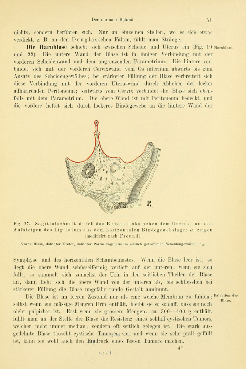 nichts, sondern Iberühren sich. ISTur an einzelnen Stellen, wo es sich etwas verdickt, z. B. an den Douglas sehen Falten, fühlt man Stränge. Die Harnlblase schiebt sich zwischen Scheide und Uterus ein (Fig. 19 Harnblase. und 22). Die untere Wand der Blase ist in inniger Verbindung mit der vorderen Scheidenwand und dem angrenzenden Parametrium. Die hintere ver- bindet sich mit der vorderen Cervixwand vom Os internum abwärts bis zum Ansatz des Scheidengewölbes; bei stärkerer Füllung der Blase verbreitert sich diese Verbindung mit der vorderen Uteruswand durch Abheben des locker adhärirenden Peritoneum; seitwärts vom Cervix verbindet die Blase sich eben- falls mit dem Parametrium. Die obere Wand ist mit Peritoneum bedeckt, und die vordere heftet sich durch lockeres Bindegewebe an die hintere Wand der Fig. 27. Sagittalschnitt durch das Becken links neben dem Uterus, um das Aufsteigen des Lig. latum aus dem horizontalen Bindegewebslager zu zeigen (modificirt nach Freund). Vorne Blase, dahinter Ureter, dahinter Portio vaginalis im seitlich getroffenen Scheidengewölbe. 'I3. Symphyse und des horizontalen Schambeinastes. Wenn die Blase leer ist, so liegt die obere Wand schüsseiförmig vertieft auf der unteren; wenn sie sich füllt, so sammelt sich zunächst der Urin in den seitlichen Theilen der Blase an, dann hebt sich die obere Wand von der unteren ab, bis schliesslich bei stärkerer Füllung die Blase ungefähr runde Gestalt annimmt. Die Blase ist im leeren Zustand nur als eine weiche Membran zu fühlen; ^aipation der Blase. selbst wenn sie massige Mengen Urin enthält, bleibt sie so schlafl, dass sie noch nicht palpirbar ist. Erst wenn sie grössere Mengen, ca. 300—400 g enthält, fühlt man an der Stelle der Blase die Eesistenz eines schlaff cystischen Tumors, welcher nicht immer median, sondern oft seitlich gelegen ist. Die stark aus- gedehnte Blase täuscht cystische TumoiTÄi vor. und wenn sie sehr prall gefüllt ist, kann sie wohl auch den Eindruck eines festen Tumors machen.