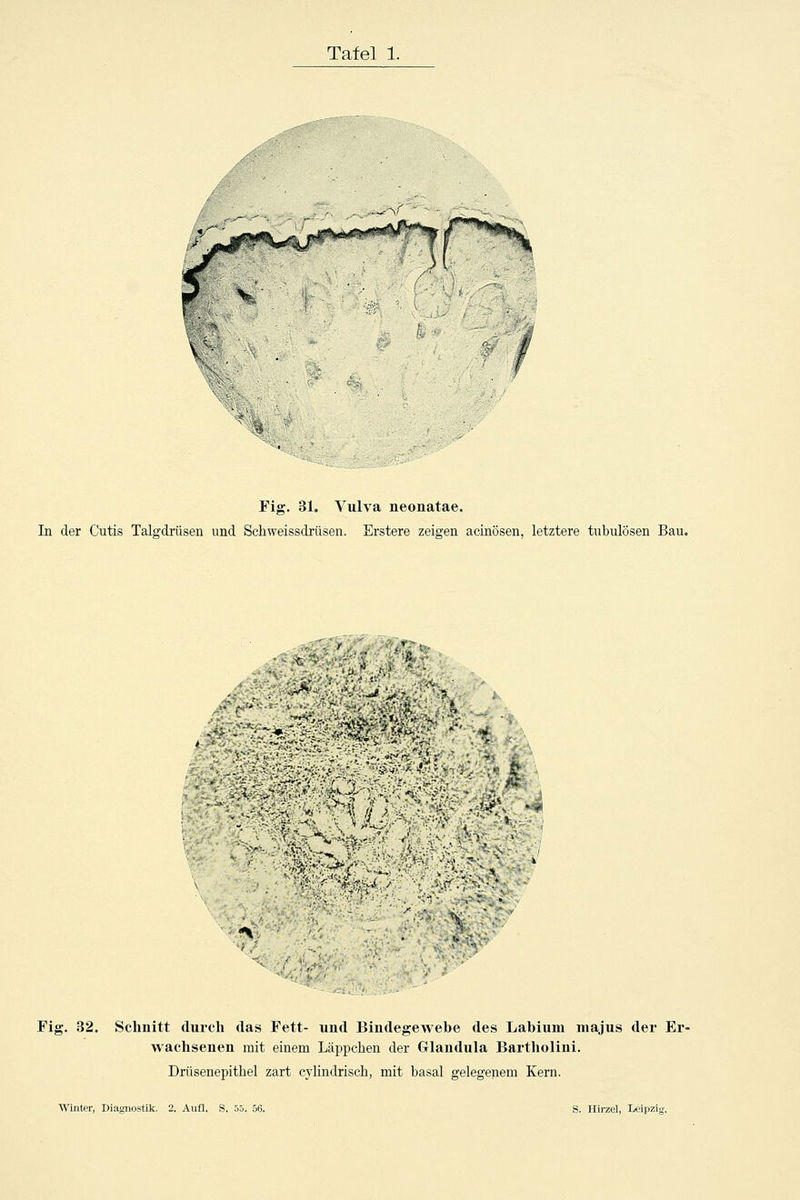 ^t.',: Fig. 31. Vulva neonatae. In der Cutis Talgdrüsen und Schweissdrüsen. Erstere zeigen aciuösen, letztere tubulösen Bau. ^•^■Vvjt^ ■'' f^ -. ■■ .r.--'■' '. ^ A::-'>•\7,>r/A^^f^j^^o;V^r■■- Fig. 32. Schnitt durch das Fett- uud Bindegewebe des Labium majus der Er- wachsenen mit einem Läppchen der Glandula Bartholini. Drüsenepitbel zart cylindrisch, mit basal gelegenem Kern.