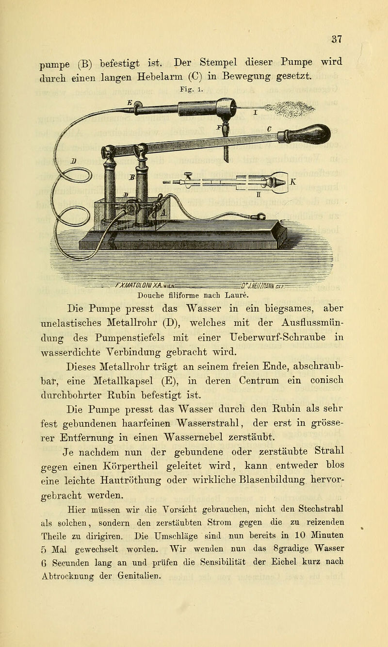 pumpe (B) befestigt ist. Der Stempel dieser Pumpe wird durcli einen langen Hebelarm (C) in Bewegung gesetzt. Fig. 1. Douche filiforme nach Laure. Die Pumpe presst das Wasser in ein biegsames, aber unelastisches Metallrobr (D), welcbes mit der Ausflussmün- dung des Pumpenstiefels mit einer Ueberwurf-Scliraube in wasserdiclite Verbindung gebracht wird. Dieses Metallrobr trägt an seinem freien Ende, abscbraub- bat, eine Metallkapsel (E), in deren Centrum ein conisch. durcbbolirter Rubin befestigt ist. Die Pumpe presst das Wasser durch den Rubin als sehr fest gebundenen haarfeinen Wasserstrahl, der erst in grösse- rer Entfernung in einen Wassernebel zerstäubt. Je nachdem nun der gebundene oder zerstäubte Strahl gegen einen Körpertheil geleitet wird, kann entweder blos eine leichte Hautröthung oder wirkliche Blasenbildung hervor- gebracht werden. Hier müssen wir die Vorsicht gebrauchen, nicht den Stechstrahl als solchen, sondern den zerstäubten Strom gegen die zu reizenden Theile zu dirigiren. Die Umschläge sind nun bereits in 10 Minuten 5 Mal gewechselt worden. Wir wenden nun das 8gradige Wasser 6 Secunden lang an und prüfen die Sensibilität der Eichel kurz nach Abtrocknung der Genitalien.