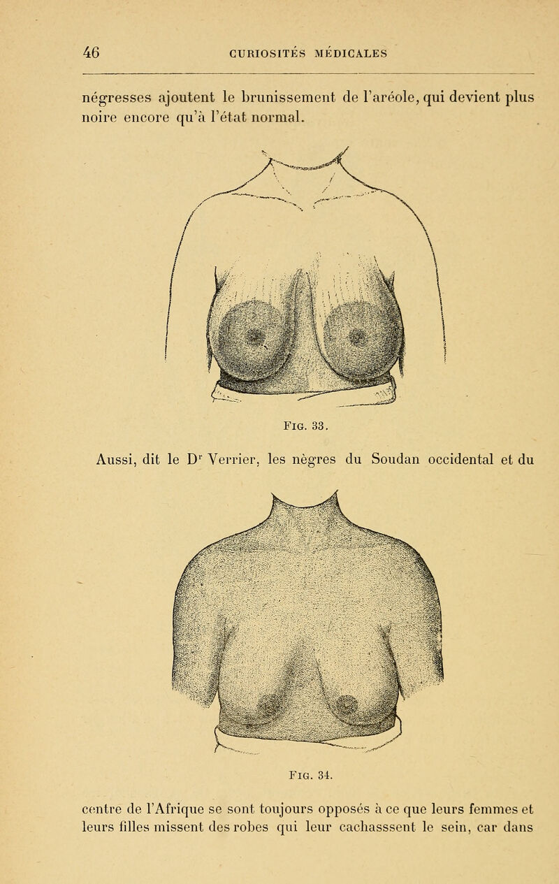 négresses ajoutent le brunissement de Faréole, qui devient plus noire encore qu'à l'état normal. FiG. 33. Aussi, dit le D'' Verrier, les nègres du Soudan occidental et du FiG. 34. centre de l'Afrique se sont toujours opposés à ce que leurs femmes et leurs filles missent des robes qui leur cachasssent le sein, car dans