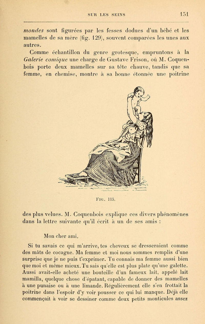 mondes sont figurées par les fesses dodues d'un bébé et les mamelles de sa mère (fig. 129), souvent comparées les unes aux autres. Comme échantillon du genre grotesque, empruntons à la Galerie comique une charge de Gustave Frison, où M. Coquen- bois porte deux mamelles sur sa tête chauve, tandis que sa femme, en chemise, montre à sa bonne étonnée une poitrine Fig. 115. des plus velues. M. Coquenbois explique ces divers phénomènes dans la lettre suivante qu'il écrit à un de ses amis : Mon cher ami, Si tu savais ce qui m'arrive, tes cheveux se dresseraient comme des mâts de cocagne. Ma femme et moi nous sommes remplis d'une surprise que je ne puis t'exprimer. Tu connais ma femme aussi bien que moi et même mieux. Tu sais qu'elle est plus plate qu'une galette. Aussi avait-elle acheté une bouteille d'un fameux lait, appelé lait mamilla, quelque chose d'épatant, capable de donner des mamelles à une punaise ou à une limande. Régulièrement elle s'en frottait la poitrine dans l'espoir d'y voir pousser ce qui lui manque. Déjà elle commençait à voir se dessiner comme deux petits monticules assez