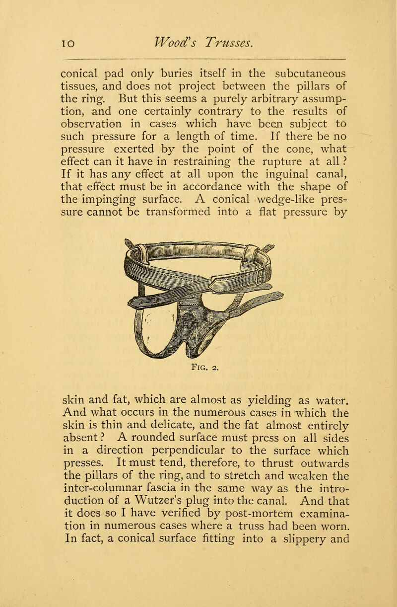 conical pad only buries itself in the subcutaneous tissues, and does not project between the pillars of the ring. But this seems a purely arbitrary assump- tion, and one certainly contrary to the results of observation in cases which have been subject to such pressure for a length of time. If there be no pressure exerted by the point of the cone, what effect can it have in restraining the rupture at all .'' If it has any effect at all upon the inguinal canal, that effect must be in accordance with the shape of the impinging surface. A conical wedge-like pres- sure cannot be transformed into a flat pressure by Fig. 2. skin and fat, which are almost as yielding as water. And what occurs in the numerous cases in which the skin is thin and delicate, and the fat almost entirely absent t A rounded surface must press on all sides in a direction perpendicular to the surface which presses. It must tend, therefore, to thrust outwards the pillars of the ring, and to stretch and weaken the inter-columnar fascia in the same way as the intro- duction of a Wutzer's plug into the canal. And that it does so I have verified by post-mortem examina- tion in numerous cases where a truss had been worn. In fact, a conical surface fitting into a slippery and