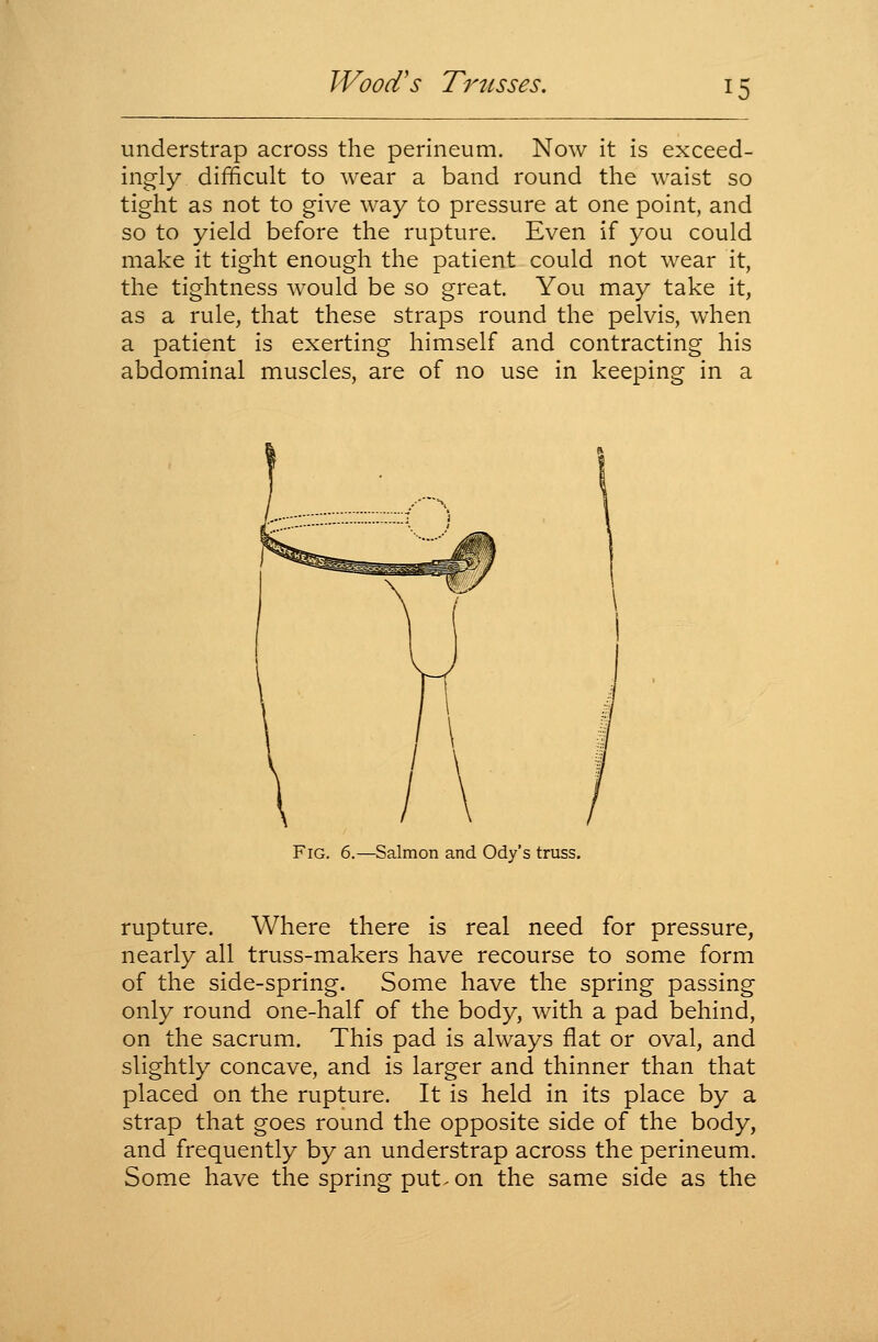 understrap across the perineum. Now it is exceed- ingly difficult to wear a band round the waist so tight as not to give way to pressure at one point, and so to yield before the rupture. Even if you could make it tight enough the patient could not wear it, the tightness would be so great. You may take it, as a rule, that these straps round the pelvis, when a patient is exerting himself and contracting his abdominal muscles, are of no use in keeping in a Fig. 6.—Salmon and Ody's truss. rupture. Where there is real need for pressure, nearly all truss-makers have recourse to some form of the side-spring. Some have the spring passing only round one-half of the body, with a pad behind, on the sacrum. This pad is always flat or oval, and slightly concave, and is larger and thinner than that placed on the rupture. It is held in its place by a strap that goes round the opposite side of the body, and frequently by an understrap across the perineum. Some have the spring put^ on the same side as the