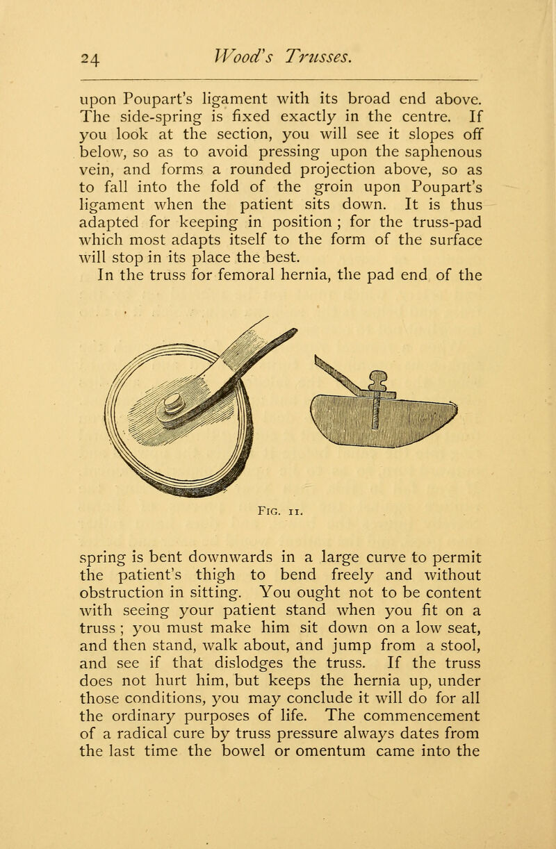 upon Poupart's ligament with its broad end above. The side-spring is fixed exactly in the centre. If you look at the section, you will see it slopes off below, so as to avoid pressing upon the saphenous vein, and forms a rounded projection above, so as to fall into the fold of the groin upon Poupart's ligament when the patient sits down. It is thus adapted for keeping in position ; for the truss-pad which most adapts itself to the form of the surface will stop in its place the best. In the truss for femoral hernia, the pad end of the Fig. II. spring is bent downwards in a large curve to permit the patient's thigh to bend freely and without obstruction in sitting. You ought not to be content with seeing your patient stand when you fit on a truss ; you must make him sit down on a low seat, and then stand, walk about, and jump from a stool, and see if that dislodges the truss. If the truss does not hurt him, but keeps the hernia up, under those conditions, you may conclude it will do for all the ordinary purposes of life. The commencement of a radical cure by truss pressure always dates from the last time the bowel or omentum came into the