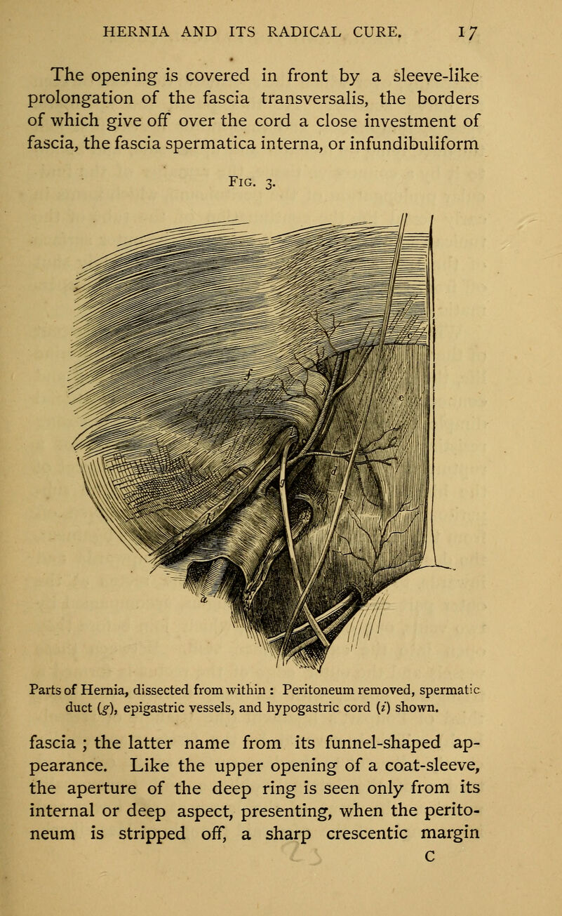 The opening is covered in front by a sleeve-like prolongation of the fascia transversalis, the borders of which give off over the cord a close investment of fascia, the fascia spermatica interna, or infundibuliform Fig. Parts of Hernia, dissected from within : Peritoneum removed, spermatic duct (^), epigastric vessels, and hypogastric cord {i) shown. fascia ; the latter name from its funnel-shaped ap- pearance. Like the upper opening of a coat-sleeve, the aperture of the deep ring is seen only from its internal or deep aspect, presenting, when the perito- neum is stripped off, a sharp crescentic margin C