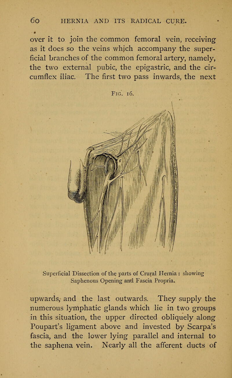 over it to join the common femoral vein, receiving as it does so the veins which accompany the super- ficial branches of the common femoral artery, namely, the two external pubic, the epigastric, and the cir- cumflex iliac. The first two pass inwards, the next Fig'. 16. Superficial Dissection of the parts of Crural Hernia : showing Saphenous Opening and Fascia Propria. Upwards, and the last outwards. They supply the numerous lymphatic glands which lie in two groups in this situation, the upper directed obliquely along Poupart's ligament above and invested by Scarpa's fascia, and the lower lying parallel and internal to the saphena vein. Nearly all the afferent ducts of