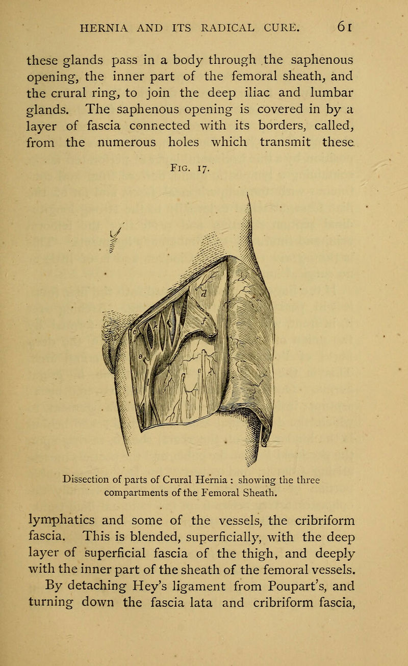 these glands pass in a body through the saphenous opening, the inner part of the femoral sheath, and the crural ring, to join the deep iliac and lumbar glands. The saphenous opening is covered in by a layer of fascia connected with its borders, called, from the numerous holes which transmit these. Fig. 17. Dissection of parts of Crural Hernia : showing the three compartments of the Femoral Sheath. lymphatics and some of the vessels, the cribriform fascia. This is blended, superficially, with the deep layer of superficial fascia of the thigh, and deeply with the inner part of the sheath of the femoral vessels. By detaching Hey's ligament from Poupart's, and turning down the fascia lata and cribriform fascia,