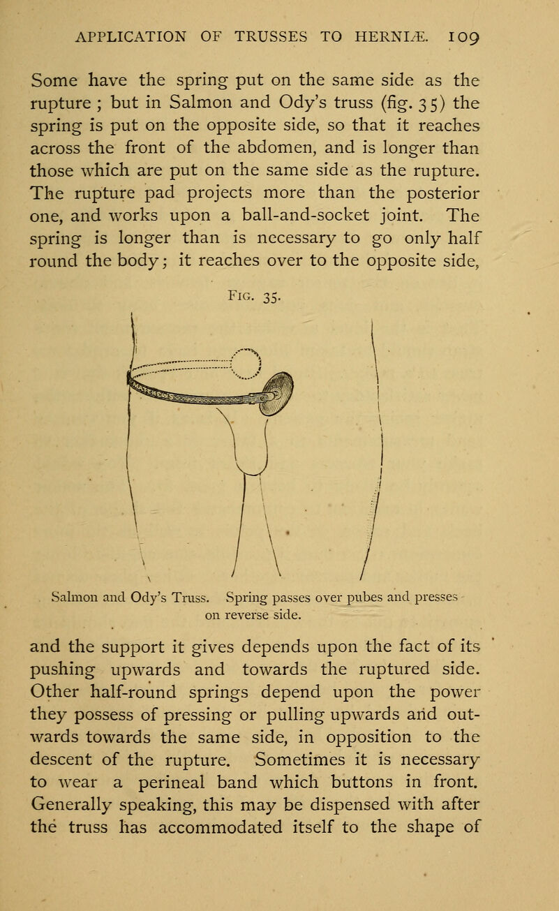 Some have the spring put on the same side as the rupture ; but in Salmon and Ody's truss (fig. 35) the spring is put on the opposite side, so that it reaches across the front of the abdomen, and is longer than those which are put on the same side as the rupture. The rupture pad projects more than the posterior one, and works upon a ball-and-socket joint. The spring is longer than is necessary to go only half round the body; it reaches over to the opposite side, Fig. 35. / Salmon and Ody's Truss. Spring passes over pubes and presses - on reverse side. and the support it gives depends upon the fact of its pushing upwards and towards the ruptured side. Other half-round springs depend upon the power they possess of pressing or pulling upwards arid out- wards towards the same side, in opposition to the descent of the rupture. Sometimes it is necessary to wear a perineal band which buttons in front. Generally speaking, this may be dispensed with after the truss has accommodated itself to the shape of