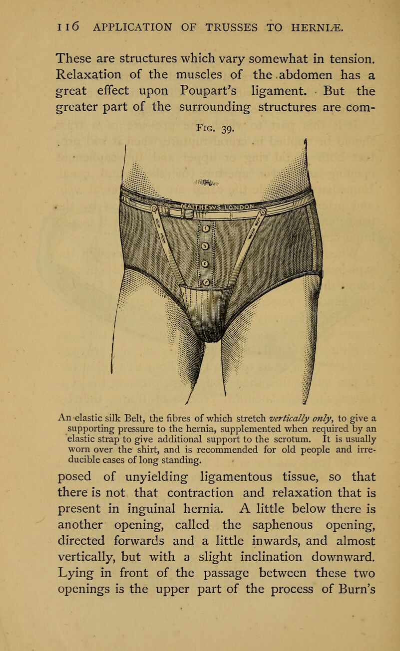 These are structures which vary somewhat in tension. Relaxation of the muscles of the.abdomen has a great effect upon Poupart's ligament. But the greater part of the surrounding structures are com- FiG. 39. An elastic silk Belt, the fibres of which stretch vertically only, to give a supporting pressure to the hernia, supplemented when required by an elastic strap to give additional support to the scrotum. It is usually worn over the shirt, and is recommended for old people and irre- ducible cases of long standing. posed of unyielding ligamentous tissue, so that there is not that contraction and relaxation that is present in inguinal hernia. A little below there is another opening, called the saphenous opening, directed forwards and a little inwards, and almost vertically, but with a slight inclination downward. Lying in front of the passage between these two openings is the upper part of the process of Burn's