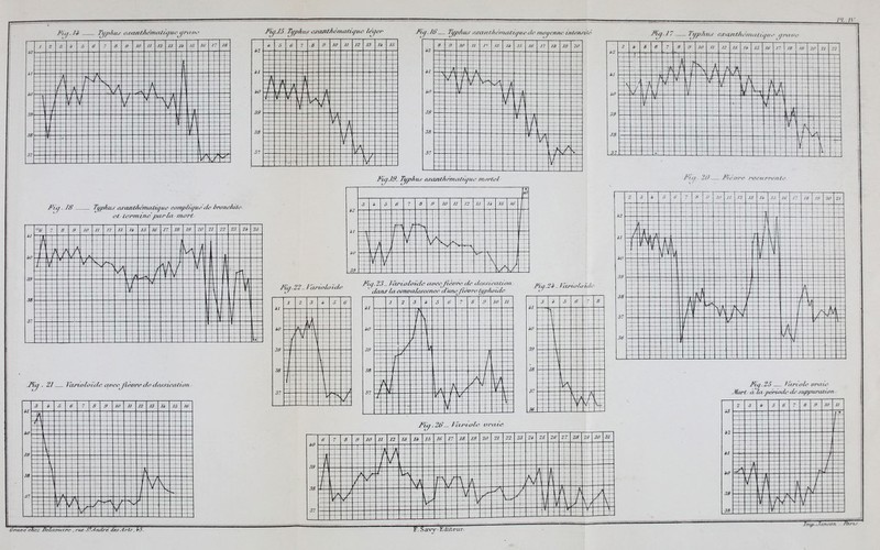 Fu/.J-i- Typhus eu-vntAématiyue <jrni><' I 2 3 II 6 6 7 8 9 10 11 12 13 li 15 16 17 18 1 T r  - Azt-T^K . — -±z-A ----- -Jj t v -»•■ A A _-_Zlz}-±-tl — ZÏS & ^_____d__ ^^ïS^c^p——^3-^-^3-t--î-:dhr----± î -h c u w v ^-,3-14- 4- 4 J » * * 4444- J_ ï v 4-l--t- 4- 39-Ï--U — [+ —l—A- ... .t =£__ _.Œ_CŒ -t r 54 JE 5 «__J . 4=—* zEzEEEEEzzEzzzzEzEEzEE^zE^zpzzzz w-====-==-z=-=—=Ï==E-=EE-Î^^z FÙJJ5. Typhus ewaJitAématiyue léqer J'iy.Jb' TypAus esta nth émut ù/ue de moue/me intensité l Fi y. 18 Typhus izrcuitAémalùjue comphyu.e'de brtmoktte et termineparlu mort T*uj . 2J lamoloide avee fièvre di? dessieatia/i 3 i. 6 6 7 8 S 10 11 12 13 U 15 w L 1 * 4 r zzt -^ztz « A = ~ = 39 —1 ^ ( t = \z ± .1 - ■ 38 —i \ 1 1 1— f\V\ 3 3 ÏÈ—-tÔ-K -~- I If rrrwH ^-EF^r^^$ ïz-~i-_ fcz=£__ ?E?! ;a a i ëïSl! f 1 I g F £ il «: I & I P Fiq.JT Typhus ejearitfyj/ntiliiiiie aruoe ï Fïq.ffl- Tuphus eaanthémaiiyue mortel P J * 5 6 7 « 9 10 11 1 2 13 li 15 16 \ - „T ± 4^- £ -f^ f*> - -i - - h « J -Eèï-h 3  3 / V Va 3=-fc-ï—fe*S^^5 a rt\ï _^3_4=—tt = ^=*Ei: J5 Mil 11111 1 1 J 1 1   v v 1 1 ^/■-~- . / cwiolv i*de Fiq.23- Thrioloïde avec fièvre de dessina U on 1 dans la*co7walesce7ice dune fièvre typhoïde Fiy.2ï - lajn-oluu &3 «i —r——r 3 i 5 6 il iO 39 38 1 2 3 i 5 b f 7 8 9 10 11 . _ ... 3 il —p- i 5 6 • « W ^\- <^H #4#fr —1_ &? m\ ffiï <W -f; J« 4 m mm ft r- — 37 ^ -/ 37 <Ï7 -j-- 36 zz^zzz *F Fùj.2à'— fiir'ivie orme m m m s 58 te i ,^- si s; Oraoe'chc:- Dalamcerc , rus SPAndré desArts, i-S. F. Savy-Edite ,—_sfc_JLzt:: tt 77 I /« W ~M il; f i /'?</ i1//''— Fièvre reçurre/ite Ï2 il il' 39 38 37 36 - 3 i 5 1/78 8 i lu 11 12 13 I* là a n 18 19 ! 20 21 \ \ '1 1 [ 'II. J ; j 1 1 r . J , .i. 1 -4-f[ IL 4- - . -f nt T 4 U- : - u j. T^ r V i . 4 _ ] : .,. / / A *' -■ - - -- A / -4 st r y \ A V ' ' \j1 . - □ t c^*> . ^ / V 4 -a t !ÎI5;î 2^-1 --jij -4 \l\ / s/ --r- / JMZZ / T ' ' sr^-\-~ t 2 / I t | _.H jA 4 3 L 1 1 Fiq.25 lâriole oraie Jilort oui périodeax' suppuration - 2 3 i i3 -t 1 1— J £ 7 « .< 10 u r ♦ Ï -A$ *2 4 i —i- —i - ^^^^ Y -4— M -3 9 -. 4 , ■ ■ f- p*\ —(— WÊÊ 38 - EzE- ï ! — — —t Tmp.KTanjon - /fe^v.»'