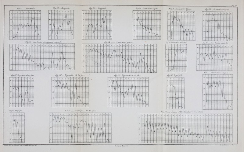 /'/.. I - Fu f.Z — /l'un yeola ■ t .5 i 7 S s •f- : iO — — -j- 1 j i -Ï&-+- z % i R i ' ; ; —, i—J çf W \ (A — ' '•/ : R- 38 — 7~~ -î- . H—! < ! i 4 .. .—. —j— Fia 'ci Rougeole Wj-29- Roxtaeole /'/y. 30—, (cclSflc Uine te'aèr< 2' a * se 7 8 9 *' - ■ : . 1 „. J ' _„_ /~rk~ : , iy ee=éë =1^3 l/ n j j- •;' . L . i _{_>._ Fùg.33- Scarlatine de-mouenne utiensUe Fïy.Ji Scarlatine qraoe • o i 11 12 J.l Ji Jô 10 n 18 1!) - « S 22 0 2* - 5_b  =r - 1 | [■ ■ . 1 ■ ■ -L ■V ÎÉËbs u> 1— •-- - ■f^fcPdp i fi /a F- :===^ï ! T' j ■ | —~±q- }-.; 'V\ AI l:rÂ ::7 i , V! v 1 \ h , ipéè i ~ Ejz- —— T /'/y.,'// Frt/si/K'/c delà ■face i ■■ 0 7 b ■9 ! _ |_ iO >\/ —t—' ,_ 39 — . 1 À =J=|N= 3i — \ J 37 Z /..'. 5lË_ —p Fia. 38 Erasipèle de lai Face, /' '</ J '9 *y >v /' èlé d s la / à iO 39 38 ?'' i à 6 7 a e m ii 12 13 7* 15 A 1 /, ï 1 ' \ A \\ \. V j\ M 1 \ \t | v • V Fu, 3J Scarlatine le'aère i  3 3 * S 6 7 8 ■ ^ÎT- .. ; : i j ; V -■t j 1 ; ! h— JU __L hn Z .... [ \ ui_k_^ ■ gnT~T^ ; :::È3 3 LJ_ 1 Fia.32 -SaiflcUi/ie ùû/è/'e Fûj. X '. ÇixirUuùu • mortclli • n - io 3y \' ' J * 1 ♦ /îï-b 'i v !■/ VN | i / 3 L, j .37 f- i — _ Fia.W- Epujipàle il W 39 38 i i 5 1 ■ : - ~\- 5 t> : « .<* /» h /; -] l\ . j ; i- . 89 — 38 — \ ' < \ bh É ï >A- Fi<i.,ÏO'— Scavlalùie mortelle. il « 9 II' u 12 13 ; /; /*• 39 38 A A p 2 V4 --L-V V ' JL i_ . f- Y i .+^ — i— —-4- i - i ■_j t; /Jy. //_ Erysipèùt </<■ lu feu-t Ki ï>2 ^'/■y 9ipt /< il iS 39 38 -' • fi - 1 \ ~ - - 1 1 r T/- Eru&tpèïe de la /!> t ^l = ï 1/ s 8 ' I :! i/1 39 38 37 S i 6 S « . - /, '/ 12 « yi / ; ie — /7 //' 20 21 1 | M t V \ ï - 1 I ■'; 1. l.-'\ ■ fl h s - -J- — V- i f n T - h' - M ' fi rj j / f J v^ i J i II - T- y j . 'A A U i « 1 \ M 1 . . «' / i i 7 i/ 1 - J^ j rf , 1 -1 1 V V -j- 1 \ H /<Y,l,!f.i fflèore. Plihfc/n'-ttulairc rémittente K ^ i Mi ï: =ï /m -v iv' vA a i ?\ ZË <■//.-.- /h-l.inini-r . rur S<,±nclrr dr.tArl.r. >.-' ■