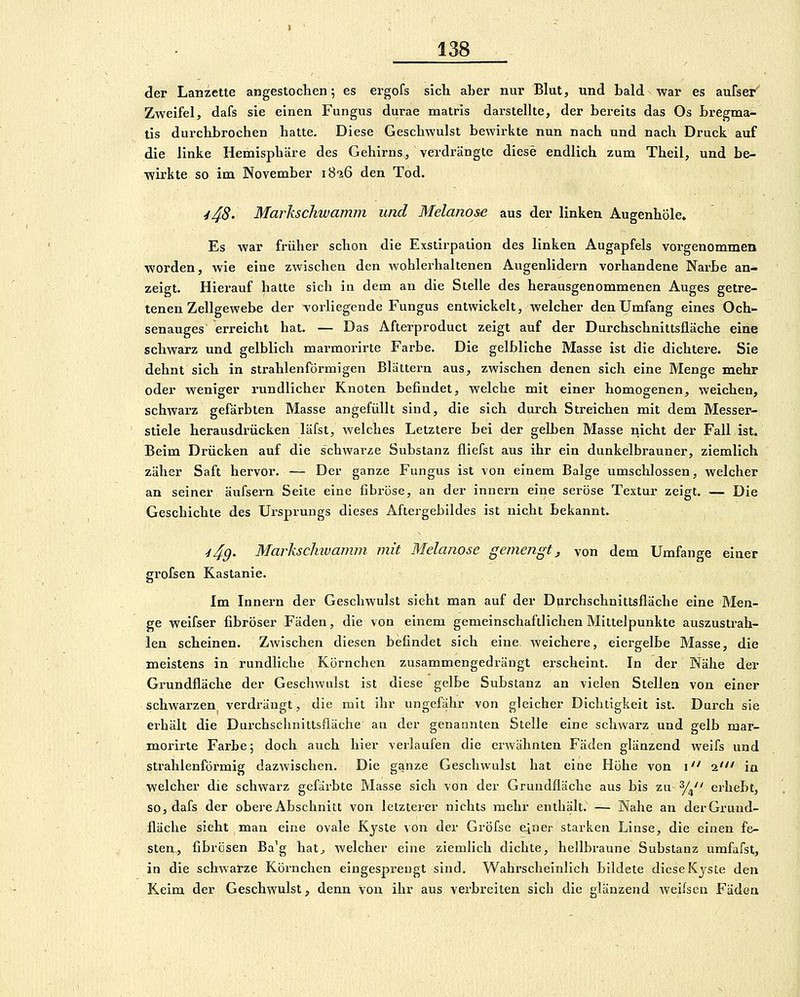 der Lanzette angestoclien; es ergofs sich aber nur Blut, und bald war es aufser' Zweifel, dafs sie einen Fungus durae matris darstellte, der bereits das Os bregma- tis durchbrochen hatte. Diese Geschwulst bewirkte nun nach und nach Druck auf die linke Hemisphäre des Gehirns, verdrängte diese endlich zum Theil, und be- wirkte so im November iS-iG den Tod. 448- Markschwamm und Melanose aus der linken Augenhöle. Es war früher schon die Exstirpation des linken Augapfels vorgenommen worden, wie eine zwischen den wohlerhaltenen Augenlidern vorhandene Narbe an- zeigt. Hierauf hatte sich in dem an die Stelle des herausgenommenen Auges getre- tenen Zellgewebe der vorliegende Fungus entwickelt, welcher den Umfang eines Och- senauges erreicht hat. — Das Afterproduct zeigt auf der Durchschnittsfläche eine schwarz und gelblich marmorirte Farbe. Die gelbliche Masse ist die dichtere. Sie dehnt sich in strahlenförmigen Blättern aus, zwischen denen sich eine Menge mehr oder weniger rundlicher Knoten befindet, welche mit einer homogenen, weichen, schwarz gefärbten Masse angefüllt sind, die sich durch Streichen mit dem Messer- stiele herausdrücken läfst, welches Letztere bei der gelben Masse nicht der Fall ist. Beim Drücken auf die schwarze Substanz fliefst aus ihr ein dunkelbrauner, ziemlich zäher Saft hervor. •— Der ganze Fungus ist von einem Balge umschlossen, welcher an seiner äufsern Seite eine fibröse, an der innern eine seröse Textur zeigt. — Die Geschichte des Ursprungs dieses Aftergebildes ist nicht bekannt. ■i49- Markschivamm mit Melanose gemengt, von dem Umfange einer grofsen Kastanie. Im Innern der Geschwulst sieht man auf der Diirchschuittsfläche eine Men- ge weifser fibröser Fäden, die von einem gemeinschaftlichen Mittelpunkte auszustrali- len scheinen. Z^vischen diesen befindet sich eine weichere, eiergelbe Masse, die meistens in rundliche Körnchen zusammengedrängt erscheint. In der Nähe der Grundfläche der Geschwulst ist diese gelbe Substanz an vielen Stellen von einer schwarzen verdrängt, die mit ihr ungefähr von gleicher Dichtigkeit ist. Durch sie erhält die Durchschnittsfläclie an der genannten Stelle eine schwarz und gelb mar- morirte Farbe; doch auch hier verlaufen die erwähnten Fäden glänzend weifs und strahlenförmig dazwischen. Die ganze Geschwulst hat eine Höhe von i i' in welcher die schwarz gefärbte Masse sich von der Grundfläche aus bis zu y^ erhebt, so, dafs der obere Abschnitt von letzterer nichts mehr enthält. — Nahe an der Grund- fläche sieht man eine ovale Kyste von der Gröfse einer starken Linse, die einen fe- sten, fibrösen Ba^g hat^ welcher eine ziemlich dichte, hellbraune Substanz umfafst, in die schwatze Körnchen eingespreugt sind. Wahrscheinlich bildete diese Kjste den Keim der Geschwulst, denn von ihr aus verbreiten sich die glänzend weifseu Fäden