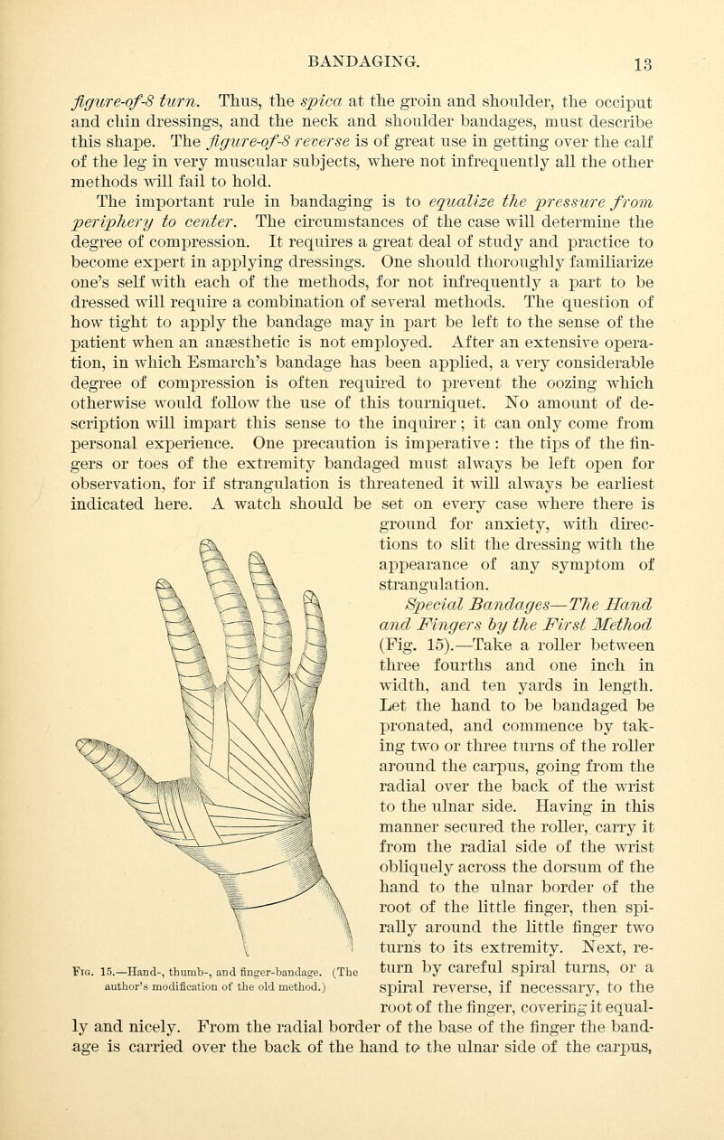 figure-of-8 turn. Thus, the spica at the groin and shonlder, the occiput and chin dressings, and the neck and shoulder bandages, must describe this shape. The figure-of-8 remrse is of great use in getting over the calf of the leg in very muscular subjects, where not infrequently all the other methods will fail to hold. The important rule in bandaging is to equalize the pressure from periphery to center. The circumstances of the case will determine the degree of compression. It requires a great deal of study and practice to become expert in applying dressings. One should thoroughly familiarize one's self with each of the methods, for not infrequently a part to be dressed will require a combination of several methods. The question of how tight to apply the bandage may in part be left to the sense of the patient when an angesthetic is not employed. After an extensive opera- tion, in which Esmarch's bandage has been applied, a very considerable degree of compression is often requked to prevent the oozing which otherwise would follow the use of this tourniquet. No amount of de- scription will impart this sense to the inquirer; it can only come from personal experience. One precaution is imperative : the tips of the fin- gers or toes of the extremity bandaged must always be left open for observation, for if strangulation is threatened it will always be earliest indicated here. A watch should be set on every case where there is ground for anxiety, with direc- tions to slit the dressing with the appearance of any symptom of strangulation. Special Bandages—The Hand and Fingers hy the First Method (Fig. 15).—Take a roller between three fourths and one inch in width, and ten yards in length. Let the hand to be bandaged be pronated, and commence by tak- ing two or three turns of the roller around the carpus, going from the radial over the back of the wrist to the ulnar side. Having in this manner secured the roller, carry it from the radial side of the wrist obliquely across the dorsum of the hand to the ulnar border of the root of the little finger, then spi- rally around the little finger two turns to its extremity. Next, re- turn by careful spiral turns, or a spiral reverse, if necessary, to the root of the finger, covering it equal- ly and nicely. From the radial border of the base of the finger the band- age is carried over the back of the hand to the ulnar side of the carpus, Fig. 15.—Hand-, thumb-, and finger-bandage. (The author's modification of the old method.)