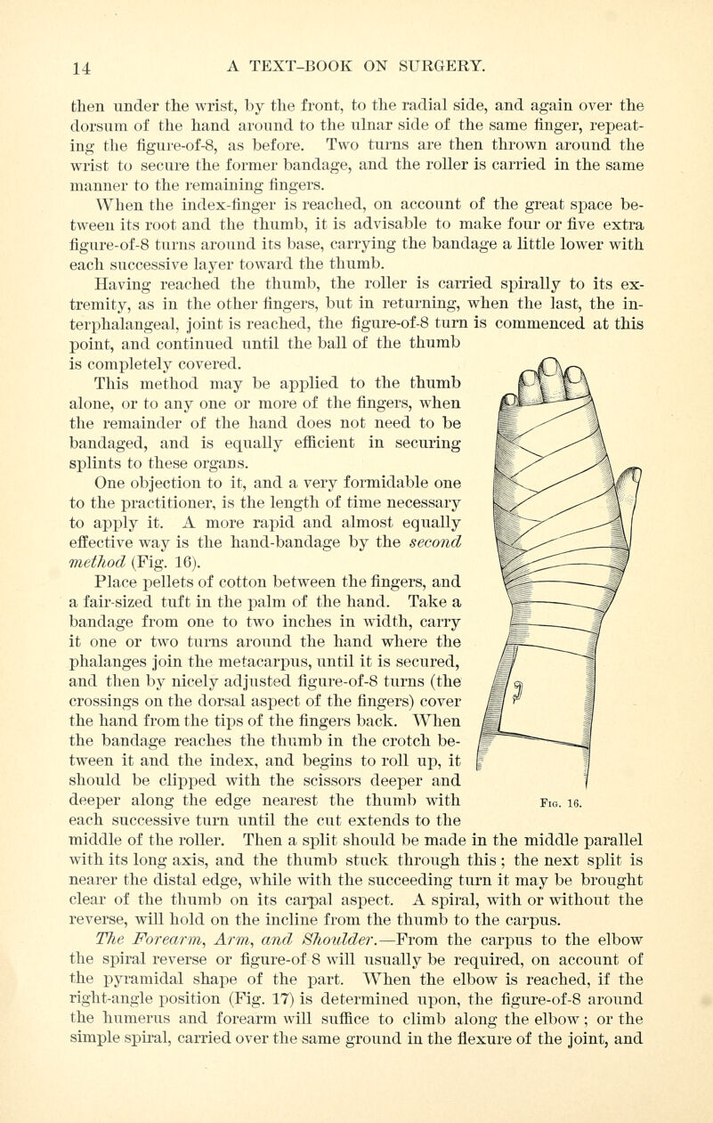 then under the wrist, by the front, to the radial side, and again over the dorsum of the hand around to the ulnar side of the same finger, repeat- ing the figure-of-8, as before. Two turns are then thrown around the wrist to secure the former bandage, and the roller is carried in the same manner to the remaining fingers. When the index-finger is reached, on account of the great space be- tween its root and the thumb, it is advisable to make four or five extra figure-of-8 turns around its base, carrying the bandage a little lower with each successive layer toward the thumb. Having reached the thumb, the roller is carried spirally to its ex- tremity, as in the other fingers, but in returning, when the last, the in- terphalangeal, joint is reached, the figure-of-8 turn is commenced at this point, and continued until the ball of the thumb is completely covered. This method may be applied to the thumb alone, or to any one or more of the fingers, when the remainder of the hand does not need to be bandaged, and is equally eflicient in securing splints to these organs. One objection to it, and a very formidable one to the practitioner, is the length of time necessary to apply it. A more rapid and almost equally effective way is the hand-bandage by the second method (Fig. 16). Place pellets of cotton between the fingers, and a fair-sized tuft in the palm of the hand. Take a bandage from one to two inches in width, carry it one or two turns around the hand where the phalanges join the metacarpus, until it is secured, and then by nicely adjusted figure-of-8 turns (the crossings on the dorsal aspect of the fingers) cover the hand from the tips of the fingers back. When the bandage reaches the thumb in the crotch be- tween it and the index, and begins to roll up, it should be clipped with the scissors deeper and each successive turn until the cut extends to the middle of the roller. Then a split should be made in the middle parallel with its long axis, and the thumb stuck through this ; the next split is nearer the distal edge, while with the succeeding turn it may be brought clear of the thumb on its carpal aspect. A spiral, with or without the reverse, will hold on the incline from the thumb to the carpus. The Forearm, Arm, and Shoulder.—From the carpus to the elbow the spiral reverse or figure-of 8 will usually be required, on account of the pyramidal shape of the part. When the elbow is reached, if the right-angle position (Fig. 17) is determined upon, the figure-of-8 around the humerus and forearm will sufiice to climb along the elbow; or the simple spiral, carried over the same ground in the flexure of the joint, and