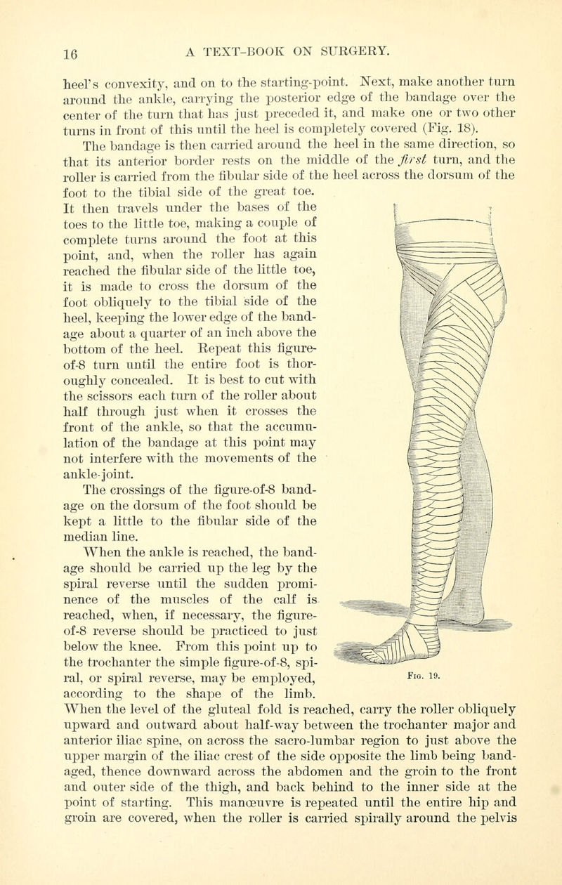 heel's convexity, and on to the starting-point. N'ext, make another turn around the ankle, carrying the posterior edge of the bandage over the center of the turn that has just preceded it, and make one or two other turns in front of this until the heel is completely covered (Fig. 18). The bandage is then carried around the heel in the same direction, so that its anterior border rests on the middle of the jirst turn, and the roller is carried from the fibular side of the heel across the dorsum of the foot to the tibial side of the great toe. It then travels under the bases of the toes to the little toe, making a couple of complete turns around the foot at this point, and, when the roller has again reached the fibular side of the little toe, it is made to cross the dorsum of the foot obliquely to the tibial side of the heel, keeping the lower edge of the band- age about a quarter of an inch above the bottom of the heel. Repeat this figure- of-8 turn until the entire foot is thor- oughly concealed. It is best to cut with the scissors each turn of the roller about half through just when it crosses the front of the ankle, so that the accumu- lation of the bandage at this point may not interfere with the movements of the ankle-joint. The crossings of the figure-of-8 band- age on the dorsum of the foot should be kept a little to the fibular side of the median line. When the ankle is reached, the band- age should be carried up the leg by the spiral reverse until the sudden promi- nence of the muscles of the calf is reached, when, if necessary, the figure- of-8 reverse should be practiced to just below the knee. From this point up to the trochanter the simple figure-of-8, spi- ral, or spiral reverse, may be employed, according to the shape of the limb. When the level of the gluteal fold is reached, carry the roller obliquely upward and outward about half-way between the trochanter major and anterior iliac spine, on across the sacro-lumbar region to just above the upper margin of the iliac crest of the side opposite the limb being band- aged, thence downward across the abdomen and the groin to the front and outer side of the thigh, and back behind to the inner side at the point of starting. This manoeuvre is repeated until the entire hip and groin are covered, when the roller is carried spirally around the pelvis