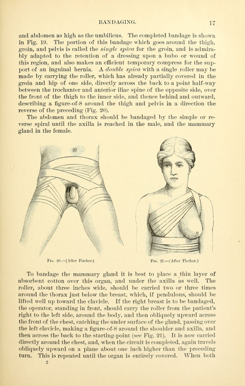 and abdomen as liigh. as the umbilicus. The completed bandage is shown in Fig. 19. The portion of this bandage which goes around the thigh, groin, and pelvis is called the single spica for the groin, and is admira- bly adapted to the retention of a dressing upon a bubo or wound of this region, and also makes an efficient temporary compress for the sup- port of an inguinal hernia. A double spica with a single roller may be made by carrying the roller, which has already partially covered in the groin and hip of one side, directly across the back to a point half-way between the trochanter and anterior iliac spine of the opposite side, over the front of the thigh to the inner side, and thence behind and outward, describing a figure-of-8 around the thigh and pelvis in a direction the reverse of the preceding (Fig. 20). The abdomen and thorax should be bandaged by the simple or re- verse spiral until the axilla is reached in the male, and the mammary gland in the female. ^ Fig. 20.—(After Fischer.) Fig. 21.—(After Fischer.) To bandage the mammary gland it is best to place a thin layer of absorbent cotton over this organ, and under the axilla as well. The roller, about three inches wide, should be carried two or three times around the thorax just below the breast, which, if pendulous, should be lifted well up toward the clavicle. If the right breast is to be bandaged, the operator, standing in front, should carry the roller from the patient's right to the left side, around the body, and then obliquely upward across the front of the chest, catching the under surface of the gland, passing over the left clavicle, making a figure-of-8 around the shoulder and axilla, and then across the back to the starting-point (see Fig. 21). It is now carried directly around the chest, and, when the circuit is completed, again travels obliquely upward on a plane about one inch higher than the preceding turn. This is repeated until the organ is entirely covered. When both 2