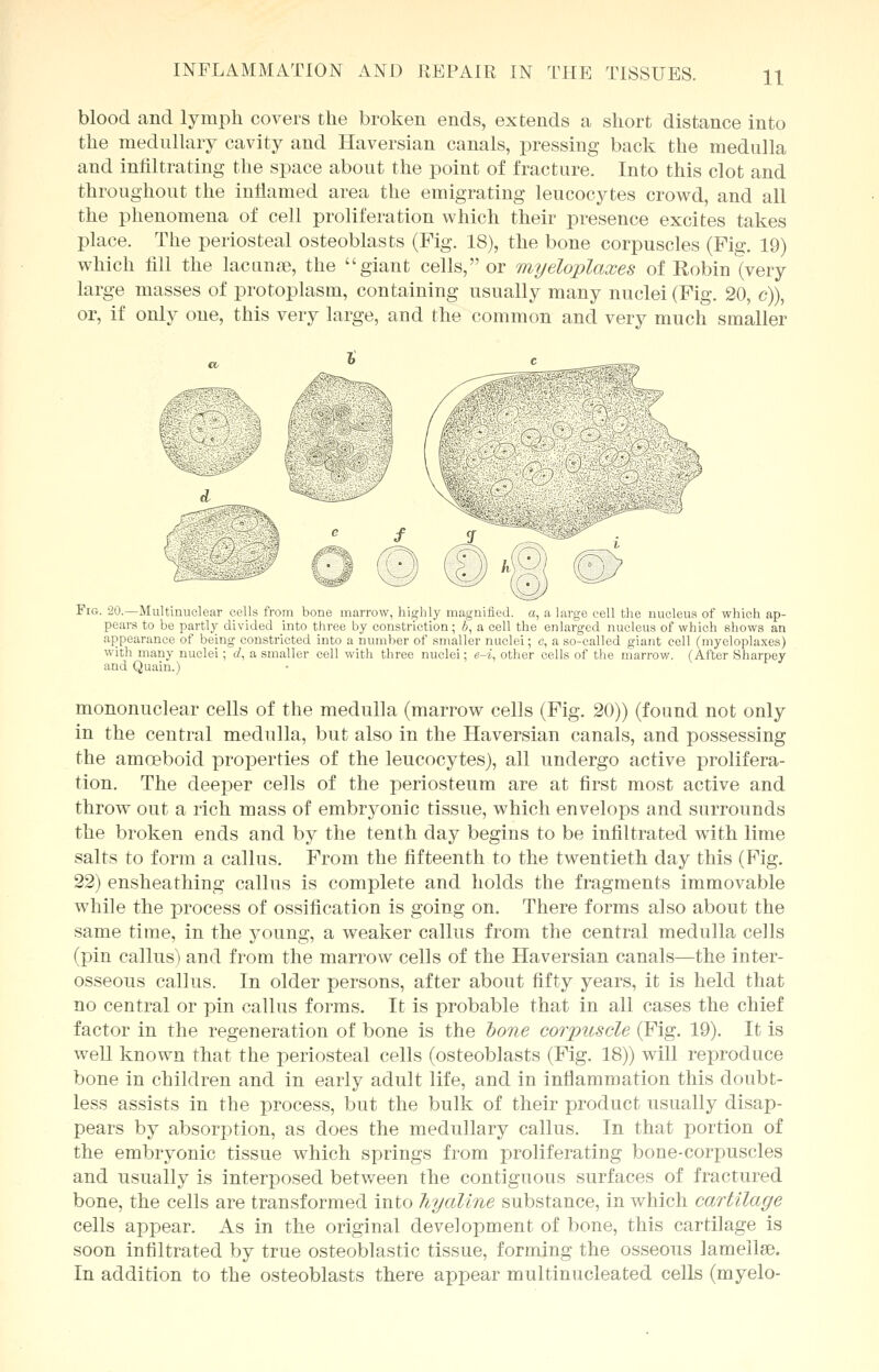 blood and lymph covers the broken ends, extends a short distance into the medullary cavity and Haversian canals, pressing back the medulla and infiltrating the space about the point of fracture. Into this clot and throughout the inflamed area the emigrating leucocytes crowd, and all the phenomena of cell proliferation which their presence excites takes place. The periosteal osteoblasts (Fig. 18), the bone corpuscles (Fig. 19) which fill the lacunae, the giant cells, or myeloplaxes of Robin ^very large masses of protoplasm, containing usually many nuclei (Fig. 20, c)), or, if only one, this very large, and the common and very much smaller Fig. 20.—Multinuclear cells from bone marrow, highly magnified, a, a large cell the nucleus of which ap- pears to be partly divided into three by constriction; b, a cell the enlarged nucleus of which shows an appearance of being constricted into a number of smaller nuclei; c, a so-called giant cell (myeloplaxes) with many nuclei; d, a smaller cell with three nuclei; e-i, other cells of the marrow. (After Sharpey and Quain.) mononuclear cells of the medulla (marrow cells (Fig. 20)) (found not only in the central medulla, but also in the Haversian canals, and possessing the amoeboid properties of the leucocytes), all undergo active prolifera- tion. The deeper cells of the periosteum are at first most active and throw out a rich mass of embryonic tissue, which envelops and surrounds the broken ends and by the tenth day begins to be infiltrated with lime salts to form a callus. From the fifteenth to the twentieth day this (Fig. 22) ensheathing callus is complete and holds the fragments immovable while the process of ossification is going on. There forms also about the same time, in the young, a weaker callus from the central medulla cells (pin callus) and from the marrow cells of the Haversian canals—the inter- osseous callus. In older persons, after about fifty years, it is held that no central or pin callus forms. It is probable that in all cases the chief factor in the regeneration of bone is the bone corpuscle (Fig. 19). It is well known that the periosteal cells (osteoblasts (Fig. 18)) will reproduce bone in children and in early adult life, and in inflammation this doubt- less assists in the process, but the bulk of their product usually disap- pears by absorption, as does the medullary callus. In that portion of the embryonic tissue which springs from proliferating bone-corpuscles and usually is interposed between the contiguous surfaces of fractured bone, the cells are transformed into hyaline substance, in which cartilage cells appear. As in the original development of bone, this cartilage is soon infiltrated by true osteoblastic tissue, forming the osseous lamellae. In addition to the osteoblasts there appear multinucleated cells (myelo-