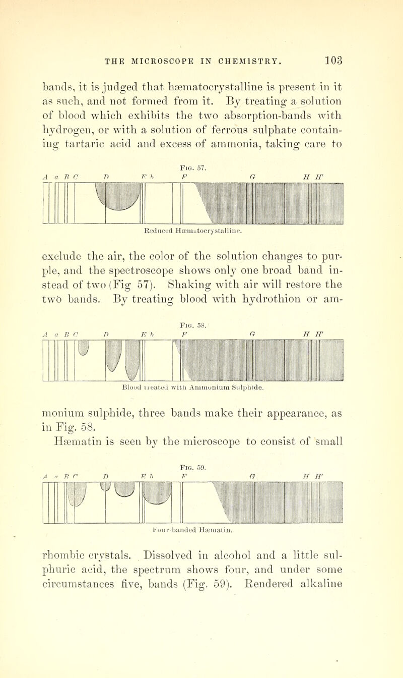 bands, it is judged that hfematocrystalline is present in it as such, and not formed from it. Bj^ treating a solution of blood which exhibits the two absorption-bands with hydrogen, or with a solution of ferrous sulphate contain- ing tartaric acid and excess of ammonia, taking care to Fig. 57. F Reduced Haiuuitocrystalliue. exclude the air, the color of the solution changes to pur- ple, and the spectroscope shows only one broad band in- stead of two (Fig 57). Sliaking with air will restore the two bands. By treating blood with hydrothiou or am- FlG. 58. F iiiiiiliiliil infix Bloud Healed with Aniniumuin ^iiljiliide. monium sulphide, three bands make their appearance, as in Fig. 58. Haematin is seen by the microscope to consist of small Fig. 59. F 11 1(5 f ilflfljl iJ___ l^uur bauded lltematin. rhombic crystals. Dissolved in alcohol and a little sul- phuric acid, the spectrum shows four, and under some circumstances five, bands (Fig. 59). Rendered alkaline