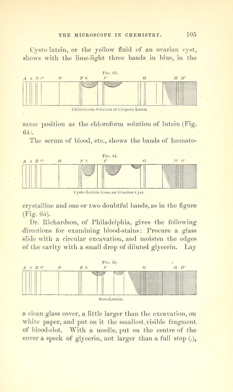 Cj'Sto lutein, or the j'ellow fluid of an ovarian cyst, shows with the linie-lio'ht three bands in blue, in the A T R r n n h Pig. 63. F G H H' MiC HiiF i : , i ') Chloroloim SuUitiuu ul Coipora Lutea. same position as the chloroform solution of lutein (Fig. 64). The serum of blood, etc., shows the bands of hiemato- A a B r Fl«. 61. F mm Cystn-Lutein lium uii Uvaiiau Cyst. crj^stalline and one or two doubtful bands, as in the figure (Fig. 65). Dr. Richardson, of Philadelphia, gives the following directions for examining blood-stains: Procure a glass slide with a circular excavation, and moisten the edges of the cavity with a small drop of diluted glycerin. Lay A n B C B b Fra. 65. F ■^mi ■ {J siiiip 1|' '■ ■'ill Sero-Luteiii. a clean glass cover, a little larger than the excavation, on white paper, and put on it the smallest visible fragment of blood-clot. With a needle, put on the centre of the cover a speck of glycerin, not larger than a full stop (.),