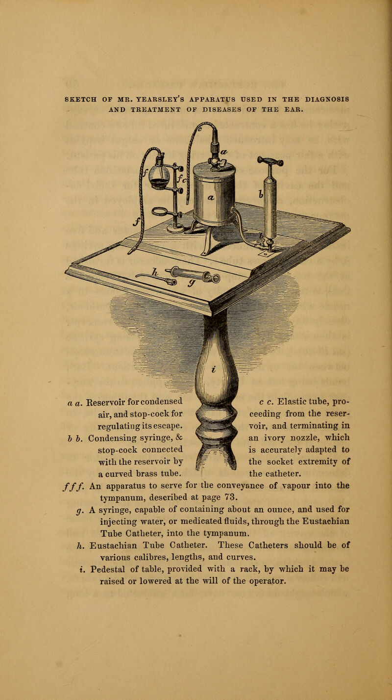 SKETCH OF MR. TEARSLEY's APPARATUS USED IN THE DIAGN08I8 AND TREATMENT OF DISEASES OF THE EAR. a a. Keservoir for condensed air, and stop-cock for regulating its escape. Condensing syringe, & stop-cock connected with the reservoir by a curved brass tube. c c. Elastic tube, pro- ceeding from the reser- voir, and terminating in an ivory nozzle, which accurately adapted to the socket extremity of the catheter. ///. An apparatus to serve for the conveyance of vapour into the tympanum, described at page 73. g. A syringe, capable of containing about an ouuce, and used for injecting water, or medicated fluids, through the Eustachian Tube Catheter, into the tympanum. h. Eustachian Tube Catheter. These Catheters should be of various calibres, lengths, and curves. i. Pedestal of table, provided with a rack, by which it may be raised or lowered at the will of the operator.