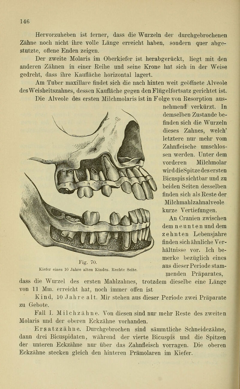 Hervorzuheben ist ferner, dass die Wurzeln der durchgebrochenen Zähne noch nicht ihre volle Länge erreicht haben, sondern quer abge- stutzte, offene Enden zeigen. Der zweite Molaris im Oberkiefer ist herabgerückt, liegt mit den anderen Zähnen in einer Eeihe und seine Krone hat sich in der Weise gedreht, dass ihre Kaufläche horizontal lagert. Am Tuber maxillare findet sich die nach hinten weit geöffnete Alveole des Weisheitszahnes, dessen Kaufläche gegen den Flügelfortsatz gerichtet ist. Die Alveole des ersten Milchmolaris ist in Folge von Resorption aus- nehmend verkürzt. In demselben Zustande be- finden sich die Wurzeln dieses Zahnes, welch' letztere nur mein vom Zahnfleische umschlos- sen werden. Unter dem vorderen Milchmolar wird dieSpitze des ersten Bicuspis sichtbar und zu beiden Seiten desselben finden sich als Reste der Milchmahlzahnalveole kurze Vertiefungen. An Cranien zwischen dem neunten und dem zehnten Lebensjahre finden sich ähnliche Ver- hältnisse vor. Ich be- merke bezüglich eines aus dieser Periode stam- menden Präparates, dass die Wurzel des ersten Mahlzahnes, trotzdem dieselbe eine Länge von 11 Mm. erreicht hat, noch immer offen ist Kind, 10 Jahre alt. Mir stehen aus dieser Periode zwei Präparate zu Gebote. Fall I. Milchzähne. Von diesen sind nur mehr Reste des zweiten Molaris und der oberen Eckzähne vorhanden. Ersatzzähne. Durchgebrochen sind sämmtliche Schneidezähne, dann drei Bicuspidaten, während der vierte Bicuspis und die Spitzen der unteren Eckzähne nur über das Zahnfleisch vorragen. Die oberen Eckzähne stecken gleich den hinteren Prämolaren im Kiefer. Fig. 70. Kiefer eines 10 Jahre alten Kindes. Eechte Seite.