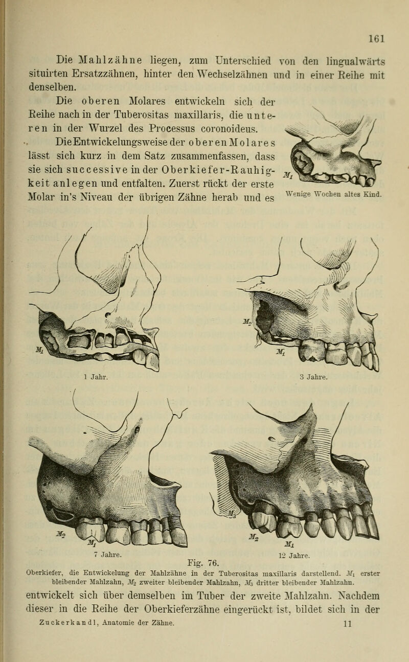 Die Mahlzähne liegen, zum Unterschied von den lingualwärts situirten Ersatzzähnen, hinter den Wechselzähnen und in einer Reihe mit denselben. Die oberen Molares entwickeln sich der Reihe nach in der Tuberositas maxillaris, die unte- ren in der Wurzel des Processus coronoideus. Die Entwickelungsweise der oberen Molares lässt sich kurz in dem Satz zusammenfassen, class sie sich successive in der Oberkiefer-Rauhig- keit anlegen imd entfalten. Zuerst rückt der erste Molar in's Niveau der übrigen Zähne herab und es Wenige Wochen altes Kind. 3 Jahre. 7 Jahre. 12 Jahre. Fig. 76. Oberkiefer, die Entwickelung der Mahlzähne in der Tuberositas maxillaris darstellend. Jfi erster bleibender Mahlzahn, Ms zweiter bleibender Mahlzahn, M3 dritter bleibender Mahlzahn. entwickelt sich über demselben im Tuber der zweite Mahlzahn. Nachdem dieser in die Reihe der Oberkieferzähne eingerückt ist, bildet sich in der Zuckerkandl, Anatomie der Zähne. \\