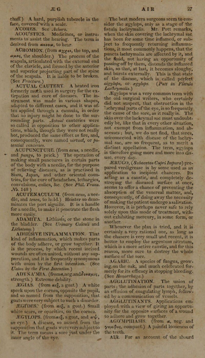 chaff.) A hard, purplish tubercle in the face, covered with a scale. A'CORES. See .ichors. ACOUSTICS. Medicines, or instru- ments to assist the hearing-. The term is derived from ecxovu, to hear. ACROMION1, (from ct^cv, the top, and 6>p*.9$, the shoulder.) The process of the scapula, articulated with the external end of the clavicle, and formed by the anterior and superior projecting part of the spine of the scapula. It is liable to be broken. (See Fracture.) ACTUAL CAUTERY. A heated iron formerly muth used in surgery for the ex- tirpation and cure of diseases. The in- strument was made in various shapes, adapted to different cases, and it was of- ten applied through a cannula, in order that no injury might be done to the sur- rounding parts, victual cauteries were so called in opposition to other applica- tions, which, though they were not really hot, produced the same effect as fire, and, consequently, were named virtual, or po- tential cauteries. ACUPUNCTURE, (from acits, a needle, and pungo, to prick.) 1'he operation of making small punctures in certain parts of the body with a needle, for the purpose of relieving diseases, as is practised in Siam, Japan, and other oriental coun- tries, for the cure of headaches, lethargies, convulsions, colics, &c. (See Phil. Trans. JVb. 148 ) ACUTENACULUM. (from acus, a nee- dle, and teneo, to held.) Heister so deno- minates the port aiguille. It is a handle for a needle, to make it penetrate the flesh more easily. ADAM1TA. Lithiasis, or the stone in the bladder. (See Urinary Calculi and Lithotomy.) ADHESIVE INFLAMMATION. That kind of inflammation, which makes parts of the body adhere, or grow together. It is the process, by which recent incised wounds are often united, without any sup- puration, and it is frequently synonymous with union by the first intention. (Sec Union hi/ the First Intention.) ADYNA'MIA. (from«,neg.and^W*,M.<s, Strength.) Extreme debility. JEGIAS. (from «»|, a goat.) A white speck upon the cornea, opposite the pupil, and so named from the supposition, that goats were very subject to sucli a disorder. JSGI'DES. '(from «<g, a goat.) Small white scars, or opacities, on the cornea. JEGYLOPS. (from«<|, a goat, and u^, an eye.) A disease, so named Er supposition that goats were very subject to term means a sore just under the inner angle of the eye. ^ The best modern surgeons seem to con- sider the aegylops, only as a stage of the fistula laohrymalis. Mr. Pott remarks, when the skin covering the lachrymal sac has been for some time inflamed, or sub- ject to frequently returning inflamma- tions, it most commonly happens, that the puncta lachrymalia are affected by it, and the fluid, not having an opportunity of passing ofl' by them, distends the inflamed skin, so that, at last, it becomes sloughy, and bursts externally. This is that state of the disease, which is called perfect aigylops, or cegylops. {Pott in Fistula Luclwymalis.) JEgylops was a very common term with the old surgical writers, who certainly did not suspect, that obstruction in the ■ achrymal parts of the eye, is so frequently the cause of the sore, as it really is. The skin over the lachrymal sac must undoubt- edly be, like that in every other situation, not exempt from inflammation, and ab- scesses ; but, we do not find, that sores, unconnected with disease of the lachry- mal sac, are so frequent, as to merit a distinct appellation. The term, aegj lops is therefore going more and more into dis- use, every day. JERUGO, (Subacetas Cupri Impura) pre- pared verdigrease is by some used as an application to incipient chancres. Its acting as a caustic, and completely de- stroying the diseased surface at once, seems to offer a chance of preventing the absorption of the venereal matter, and, consequently, of doing away the necessity of making the patient undergo a salivation. However, it is perhaps never safe to rely solely upon this mode of treatment, with- out exhibiting mercury, in some form, or another. Whenever the plan is tried, and it is certainly a very rational one, as long as the chancre is very small and recent, it is better to employ the argentnm nitratum, which is a more active caustic, and for this reason, more sure to destroy the whole surface of the sore. AGARIC. A species of fungus, grow-- ing on the oak, and much celebrated for- merly for its efficacy in stopping bleeding. (See Hemorrhage.) AGGLUTINATION. The union of parts ; the adhesion of parts together, by an effusion of coagulating- lymph, follow- ed bv a communication of vessels. AGGLUTINANTS. Applications em- ploye I with a view of g'iving an opportu- nity for the opposite surfaces of a wound to adhere and grow tog-ether. AGO/MPHIASIS. (from <*, neg. and yof*.tyo<;, compact.) A painful looseness of the teeth. ALR. For an account of the absurd