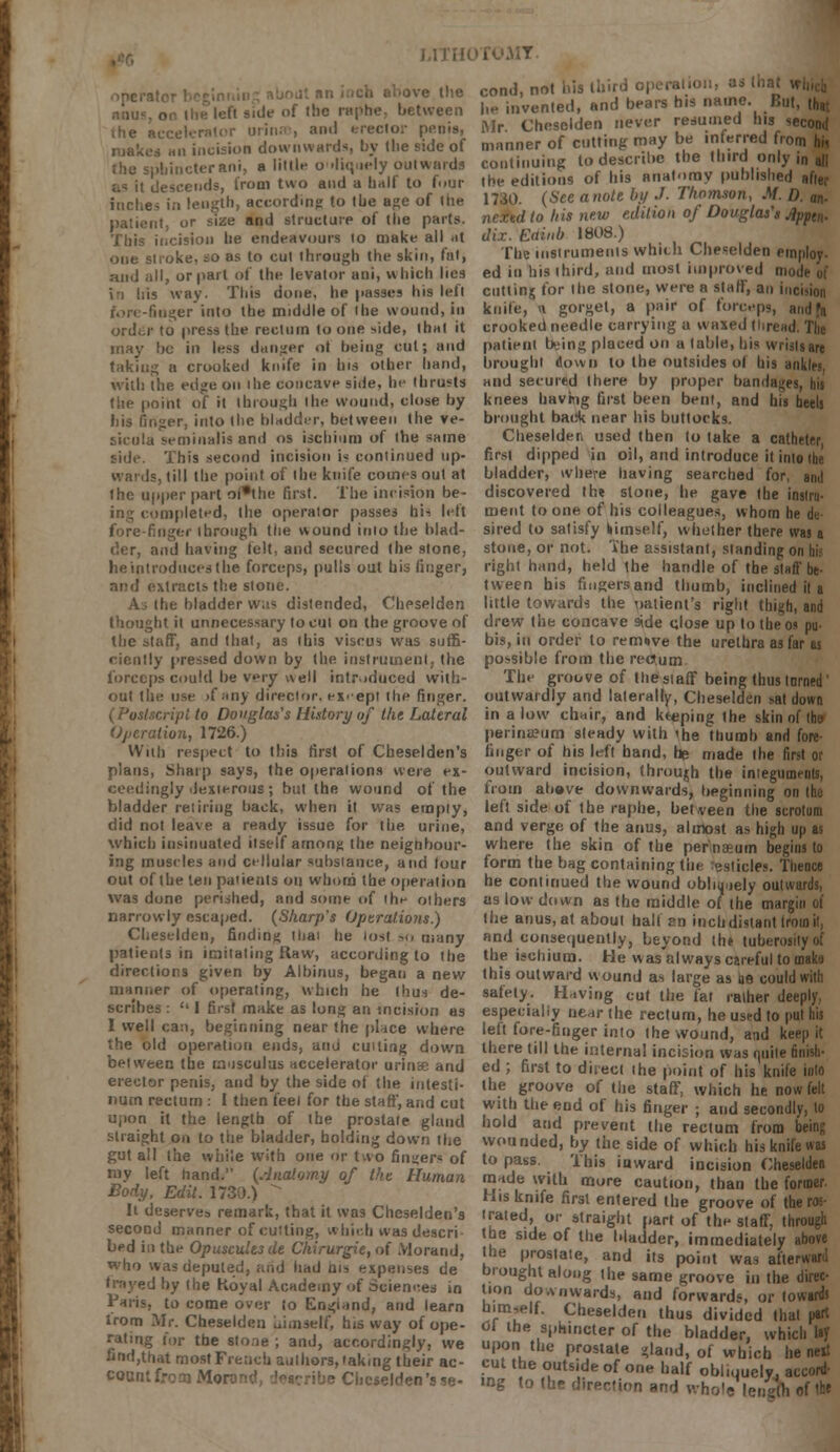 MY cond, not his ihird operation, as lhal fachesTn length, according to the age of the 1730. (See anote by J. Thomson M. D. an. patient, or size and structure of the parts. M&dlohis new edition oj Douglas * J}pptn. This incision he endeavours to make all .it dix. Eainb i«08.) one stroke, so as to cut through the skin, fat, The instruments which Cheselden employ, and all, or part of the levator ani, which lies ed in his third, and most unproved ni in his way. This done, he passes his left cutting for the stone, were a staff, an incision fore-finger into the middle of the wound, in knife, <i gorget, a pair of forceps, order to press the rectum to one side, that it crooked needle carrying a waxed thread. The may he in less danger ot heiug cut; and patient being placed on a table, bis wrislsare taking a crooked knife in Ins other hand, brought down to the outsides ot bis anklri with the edge on the concave side, be thrusts and secured there by proper bandages, hit the point of it through the wound, close by knees having first been bent, and his heels his finger, into the bladder, between the ve- brought back near his buttocks. sicula setninalis and os ischium of the same Cheselden used then to take a catheter, side. This second incision is continued up- first dipped in oil, and introduce it into the wards, till the point of the knife comes out at bladder, where having searched for, ami the upper part ol'the first. The incision be- discovered the stone, he gave the insur- ing completed, the operator passes his left ment to one of his colleagues, whom he de- forefinger through the wound into the blad- sired to satisfy himself, whether there was a der, and having felt, and secured the stone, stone, or not. The assistant, standing on bii he introduces the forceps, pulls out bis finger, right hand, held the handle of the staff be- and extracts the stone. tween bis fingers and thumb, inclined it a As the bladder was distended, Cheselden little towards the oatient's right thi^h, and thought it unnecessary to cut on the groove of drew the concave side close up to the os pu- the staff, and that, as ibis viscus was suffi- bis, in order to remiive the urethra as far as rienlly pressed down by the instrument, the possible from the rectum. forceps could be very'well introduced with- The groove of the staff being thus turned' out the use >f any director, except the finger, outwardly and laterally, Cheselden sat down to Douglas's History of the Lateral in a low chair, and keeping the skin ol Operation, 1726.) perina?um steady with the thumb and fore- With respect to this first of Cheselden's finger of his left hand, he made the first or plans, Sharp says, the operations were ex- outward incision, through the integuments, ceedingly dexterous; but the wound of the from above downwards, beginning 01 bladder retiring back, when it was empty, left side of the raphe, between the scrotum did not leave a ready issue for the urine, and verge of the anus, almost as high up as which insinuated itself among the neighbour- where the skin of the pernaum begins to ing muscles and cellular substance, and tour form the bag containing the testicles. Thence out of the ten patients on whom the operation he continued the wound obliquely outwards, was done perished, and some of thn others as low down as the middle of the margin of narrowly escaped. (Sharp's Operations.) the anus, at about half an inch distant from it, Cheselden, finding thai he lost so. many and consequently, beyond the tuberosity of patients in imitating Raw, according to the the ischium. He was always careful to mako the old operation ends, and cutting down there till the internal incision was finite finish- between the rausculus accelerator urina and ed ; first to direct the point of his knife into erector penis, and by the side of the intesti- the groove of the staff, which he now felt num rectum : I then feel for the staff, and cut with the end of his finger ; and secondly, to upon it the length of the prostate gland hold and prevent the rectum from being straight on to the bladder, holding down the won nded, by the side of which his knife was gut a I the •brie with one or two finder* of to pass. This inward incision Cheselden rL) rfini-*J  V °f maH Tdrviih mre caut'°> 'ban the foroier. Body Edit. 1,30.) His knife first entered the groove of the m- It deserve, remark, that it was Cheselden's 1 rated, or straight part of the staff through second manner of cutting, which was descri- the side of the bladder, immedUelv bo ' tT^ved hv^ ' >l'I A J ;*PBSeS de bl'0,,ght al°S ,he same groove in the direc frayed by the Koyal Academy of awences in tion downwards, and forwards or toward! Pans, to come over to England, and learn bim,elf Clieselh, ihTr ^ , , I from Mr. Cheselden himself, h,s way of ope- of theSphincter of thl\t\ t I ft rating for the stone ; and, accordingly, we upon tlenrostate Jlam! I !' II „ 1 find thatmo^Frhlhaki^rac. Zxt^ZToXl^^y^Sl count froai Mora- Cheselden's se- ing to the di rectum and whole length of the