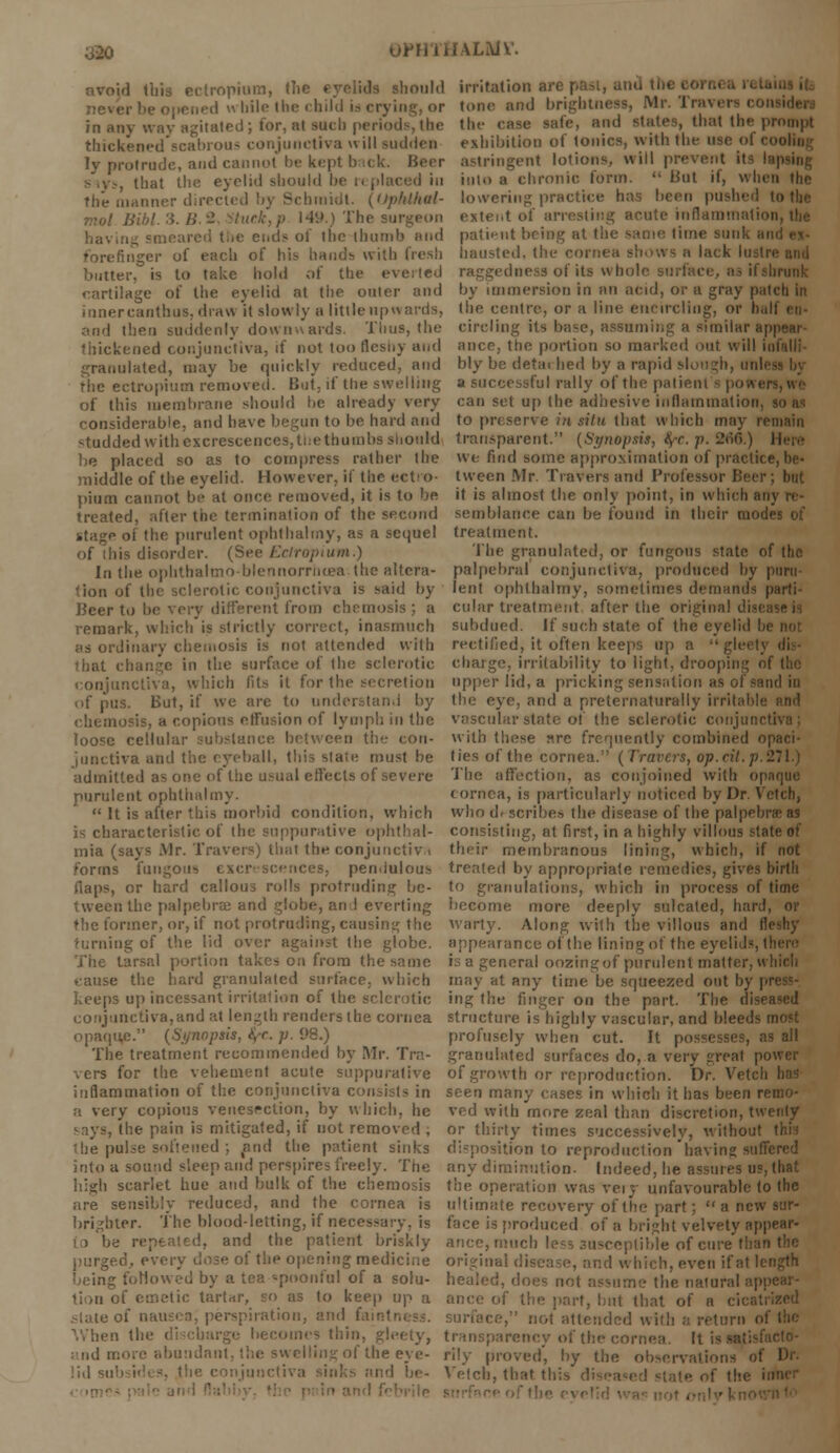 y20 uWJ'UULiVlV. avoid ibis ectropium, the eyelids should irritation are past, anil tin d while the child is crying, or tone and brightness, Mr.'inn. inan- led; for, at such periods, the the case sate, and states, that the prompt thickened scabrous conjunctiva will sudden exhibition of tonics, with the use oi ■ ■ ly protrude, and cannot be kept back. Beer astringent lotions, will prevent its I sws, that the eyelid should be replaced in into a chronic form. But if, when the the manner directed by Schmidt, (uplillial- lowering practice has been pushed to the Bibl.3.B.i 149.) The surgeon eit< < inflamtnatioi having smeared the ends of the thumb and patient being at the same lime sunk bi forefinger of each of his bauds with fresh hausted, the cornea shows n lack lusti butter, is to take hold of the everted raggedness of its whole surface, as il cartilage of the eyelid at the outer and by immersion in an acid, or a gray patch in innercanthus, draw it slowly a little upwards, the centre, or a line encircling, or bal then suddenly downwards. Tims, the circling its base, assuming a similar appear- i ued conjunctiva, if not too fleshy and ance. the portion so marked out will infalli granulated, may be quickly reduced, and bly be detached by a rapid slough, unli the ectropium removed. Cut. if the swelling a successful rally of the patient of this membrane should be already very can set up the adhesive inflammation, goal considerable, and have begun to be hard and to preserve in situ that which may remain studdedwithexcrescences,ttiethumbs should transparent. (Synopsis, $r. p. 2*if>.) Hera be placed so as to compress rather the we find some approximation of practice,be- middle of the eyelid. However, il the ectro- tween Mr. Travels and Professor Beer; but pium cannot be at once removed, it is to be it is almost the only point, in which an treated, after the termination of the second semblance can be found in their modes of stage oi the purulent ophthalmy, as a sequel treatment. of this disorder. (See Ectropium.) The granulated, or fungous state of the In the ophthalmo-blennorrhcea-.the altera- palpebral conjunctiva, produced by parti- tion of the sclerotic conjunctiva is said by lent ophthalmy, sometimes demands parti- Beer to be very different from chemosis ; a cular treatment after the original disi remark, which is strictly correct, inasmuch subdued. If such state of the eyelid I as ordinary chemosis is not attended with rectified, it often keeps up a  that change in the surface of the sclerotic charge, irritability to light, drooping ol conjunctiva, which fits it for the secretion upper lid, a pricking sensation as of sand in <>f pus. But, if we are to understand by the eye, and a preternaturally irritable chemosis, a copious effusion of lymph in the vascular state of the sclerotic conjunct loose cellular substance between th-' con- with these sre frequently combined opaci- junctiva and the eyeball, this state must be ties of the cornea. (Travers, op.cil.p.i admitted as one of the usual effects of severe The affection, as conjoined with opaque purulent ophthalmy. cornea, is particularly noticed by Dr. Vetch,  It is after this morbid condition, which who describes the disease of the palpebral as is characteristic of the suppurative ophthal- consisting, at first, in a highly villous state of mia (says Mr. Travers) that the conjunctiva their membranous lining, which, if not forms fungous excrescences, pendulous treated by appropriate remedies, gives birth flaps, or hard callous rolls protruding be- to granulations, which in process of time tween the palpebral and globe, and everting become more deeply sulfated, hard, or the former, or, if not protruding, causing the warty. Along with the villous and fleshy turning of the lid over against the globe, appearance of the lining of the eyelids, there The tarsal portion takes on from the same is a general oozing of purulent matter, w cause the hard granulated surface, which may at any time be squeezed out by \ keeps up incessant irritation of the sclerotic ing the finger on the part. The diseased conjunctiva, and at length renders the cornea structure is highly vascular, and bleeds most opaque. (Synopsis, <*,-r. /;. 98.) profusely when cut. It possesses, as all The treatment recommended by Mr. Tra- granulated surfaces do, a very great power \ers for the vehement acute suppurative of growth or reproduction. Dr. Vetch inflammation of the conjunctiva consists in seen many cases in which it has been n a very copious venesection, by which, he ved with more zeal than discretion, twenty says, the pain is mitigated, if not removed , or thirty times successively, without this the pulse softened ; and the patient sinks disposition to reproduction'bavins; suffered into a sound sleep and perspires freely. The any diminution- Indeed, he assures us, that high scarlet hue and bulk of the chemosis the operation was veiy unfavourable to the are sensibly reduced, and the cornea is ultimate recovery of the part; anew brighter. The blood-letting, if necessary, is face is produced of a bright velvety appear- to be repeated, and the patient briskly ance, much less susceptible of cure than the purged, every dose of the opening medicine original dii hich, even if at length followed by a tea «pnonful of a solu- healed, doi me the natural app lion of emetic tartar, so as to keep up a ance of the part, but that of a .-late of nauscaj perspiration, and faintn . :,l attended with :-. return of the When the discbarge becomes thin, gleety, transparem facto- and more abundant, the swelling of the eye- rily proved, by the obscrvatioi lid subsides, the conjunctiva sinks and lie- Vetch, that this ip of the in
